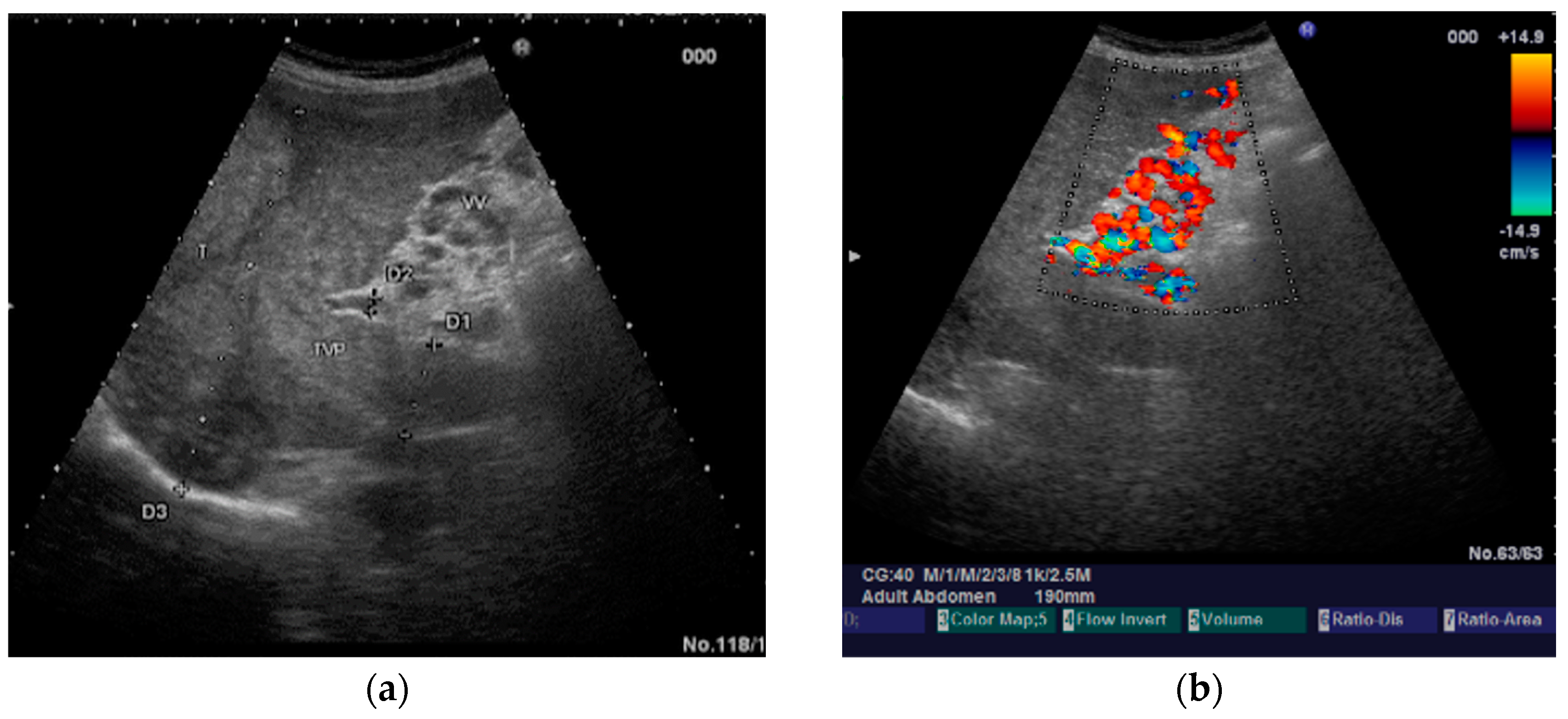 Diagnostics 14 01445 g001