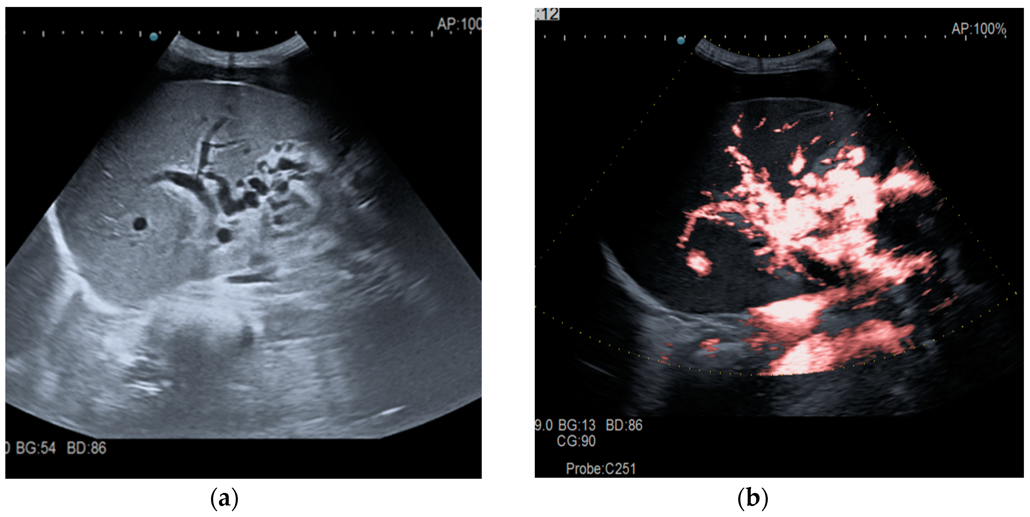 Diagnostics 14 01445 g002