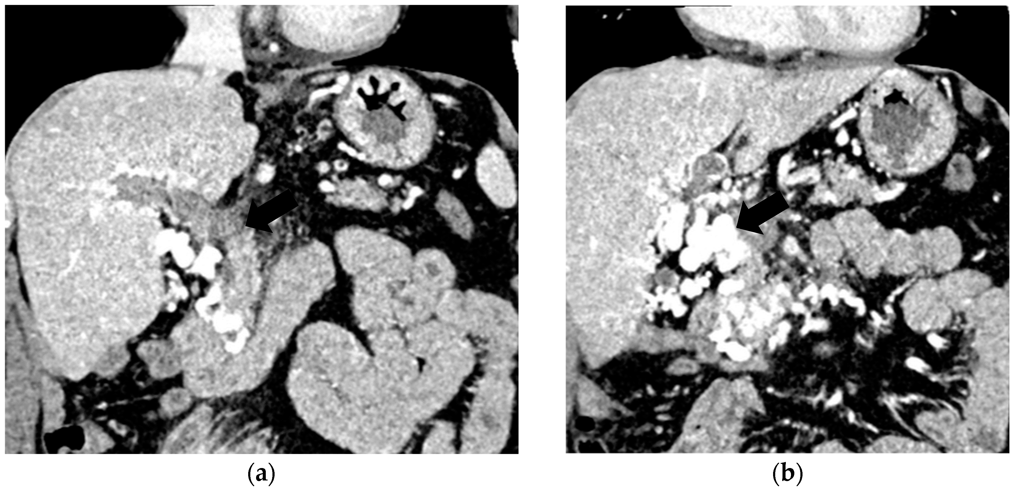 Diagnostics 14 01445 g003