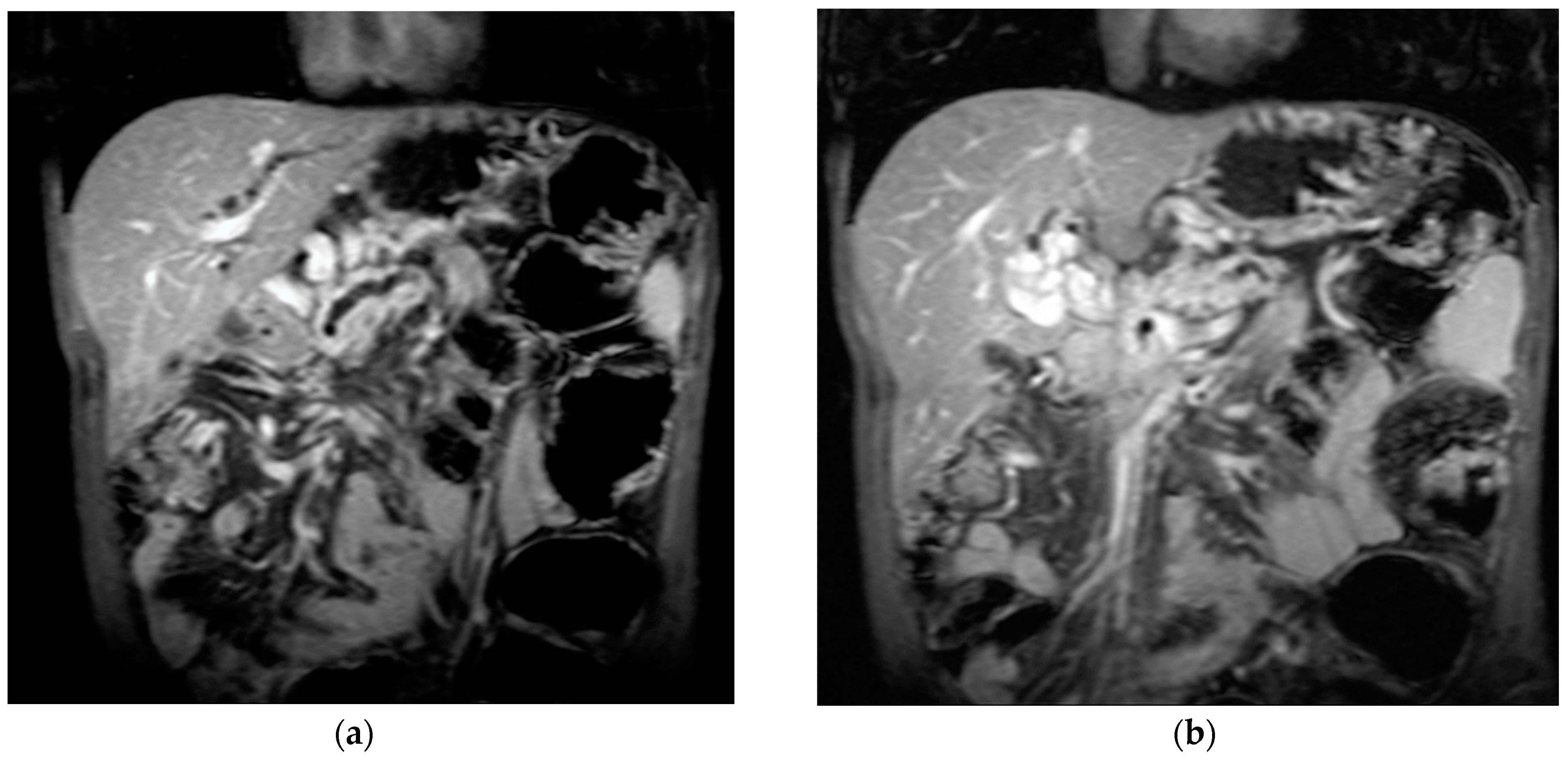 Diagnostics 14 01445 g004