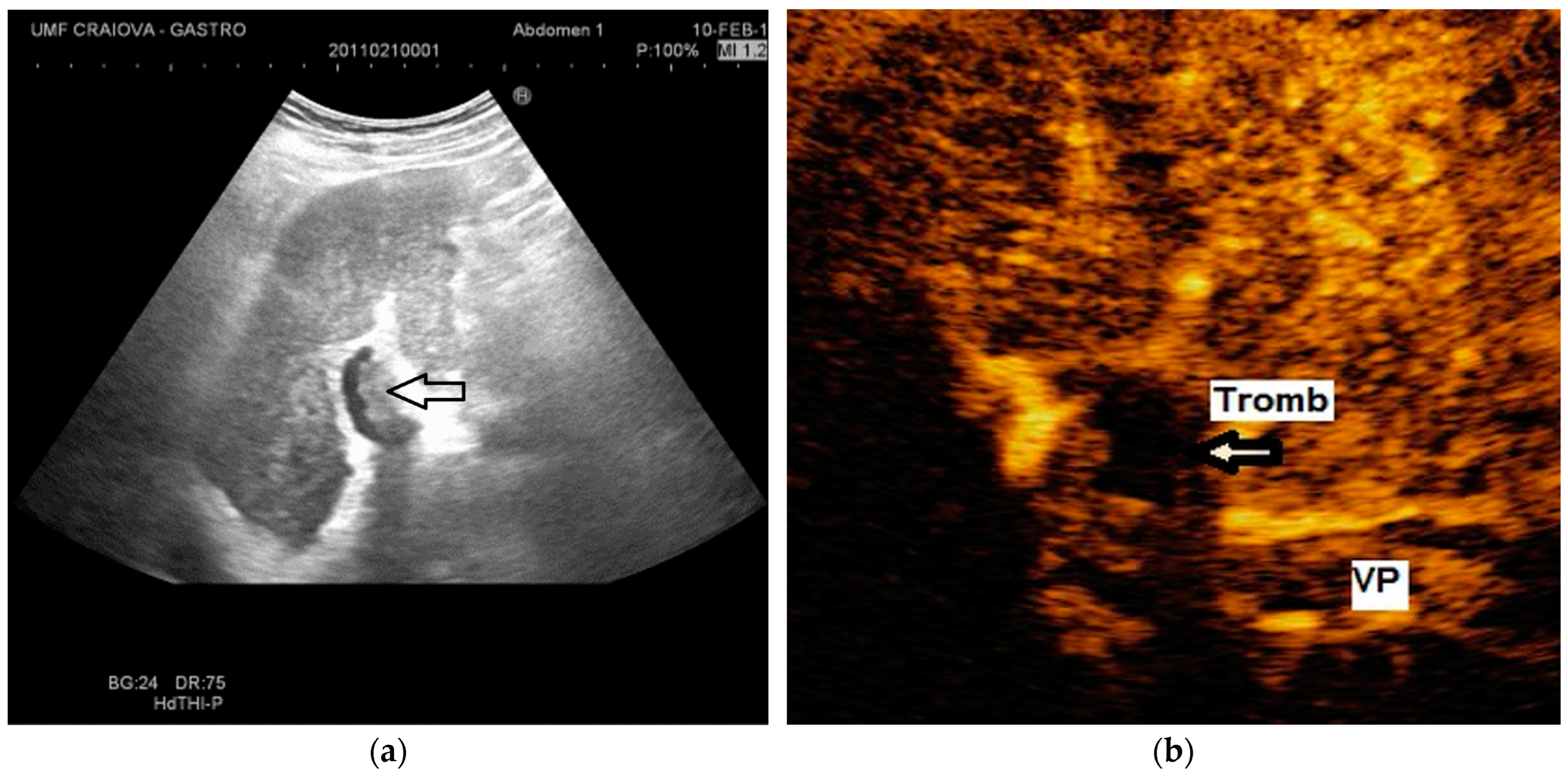 Diagnostics 14 01445 g005