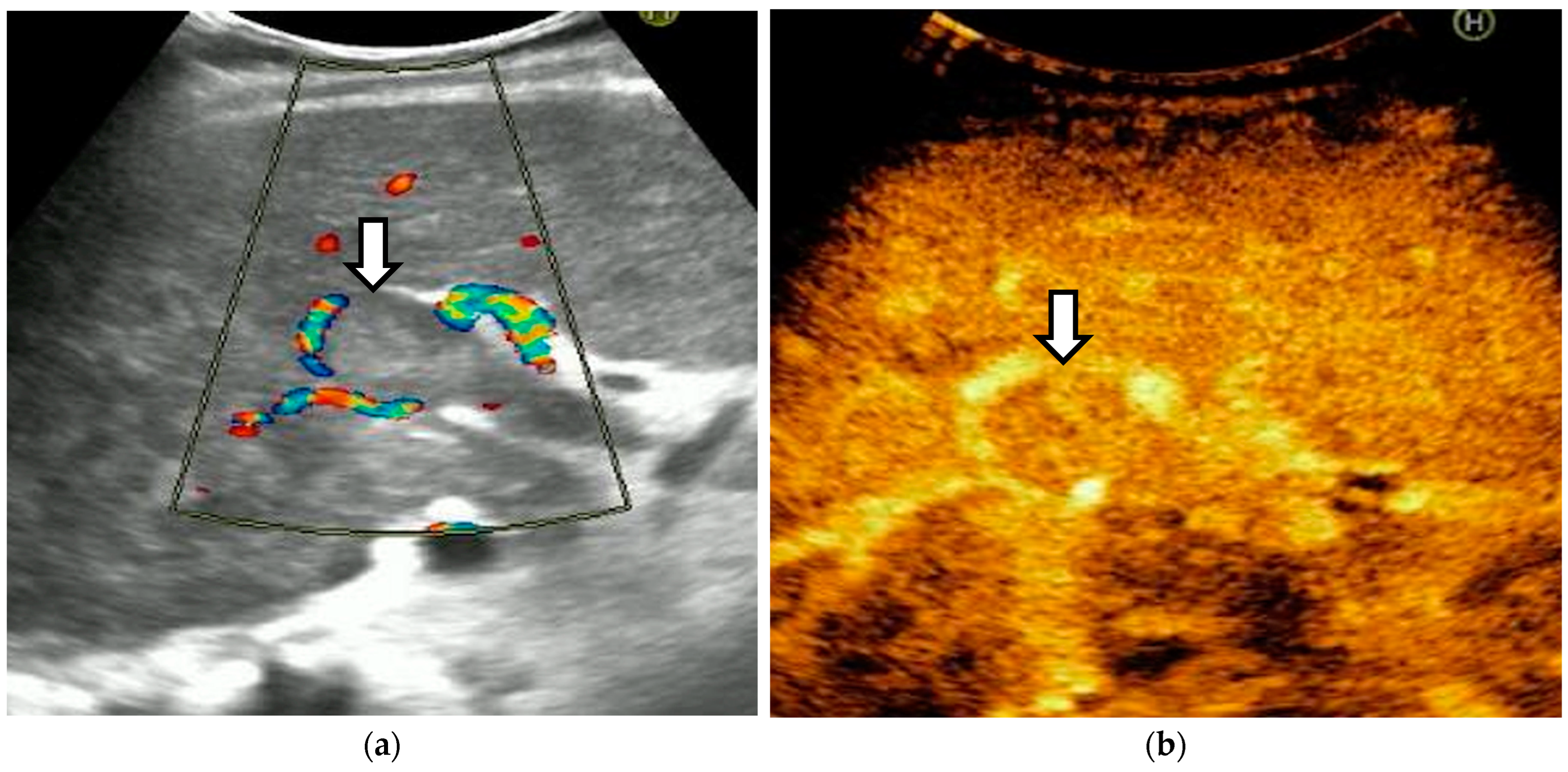 Diagnostics 14 01445 g006