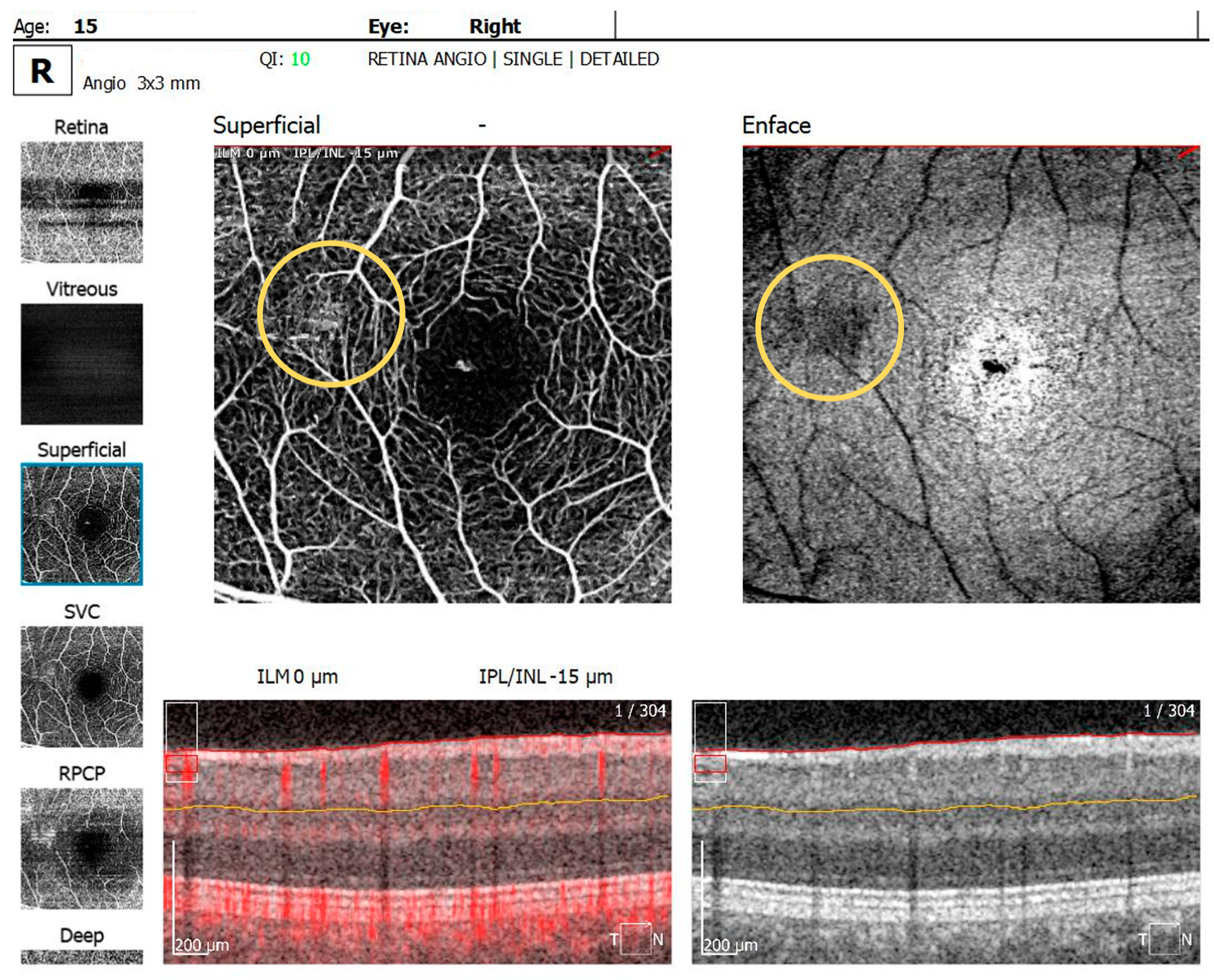 Diagnostics 14 01447 g005a
