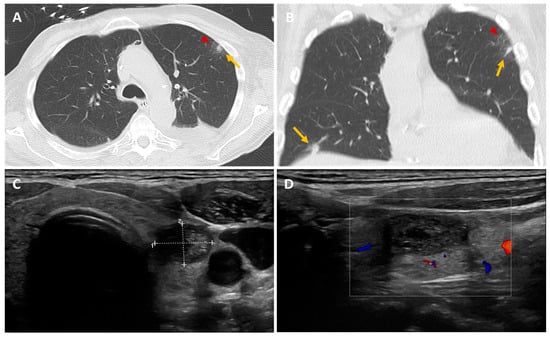 Diagnostics 14 01451 g001