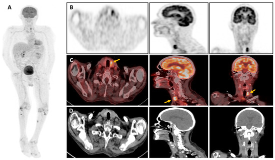 Diagnostics 14 01451 g002