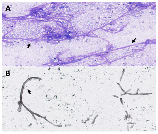 Diagnostics 14 01451 g003