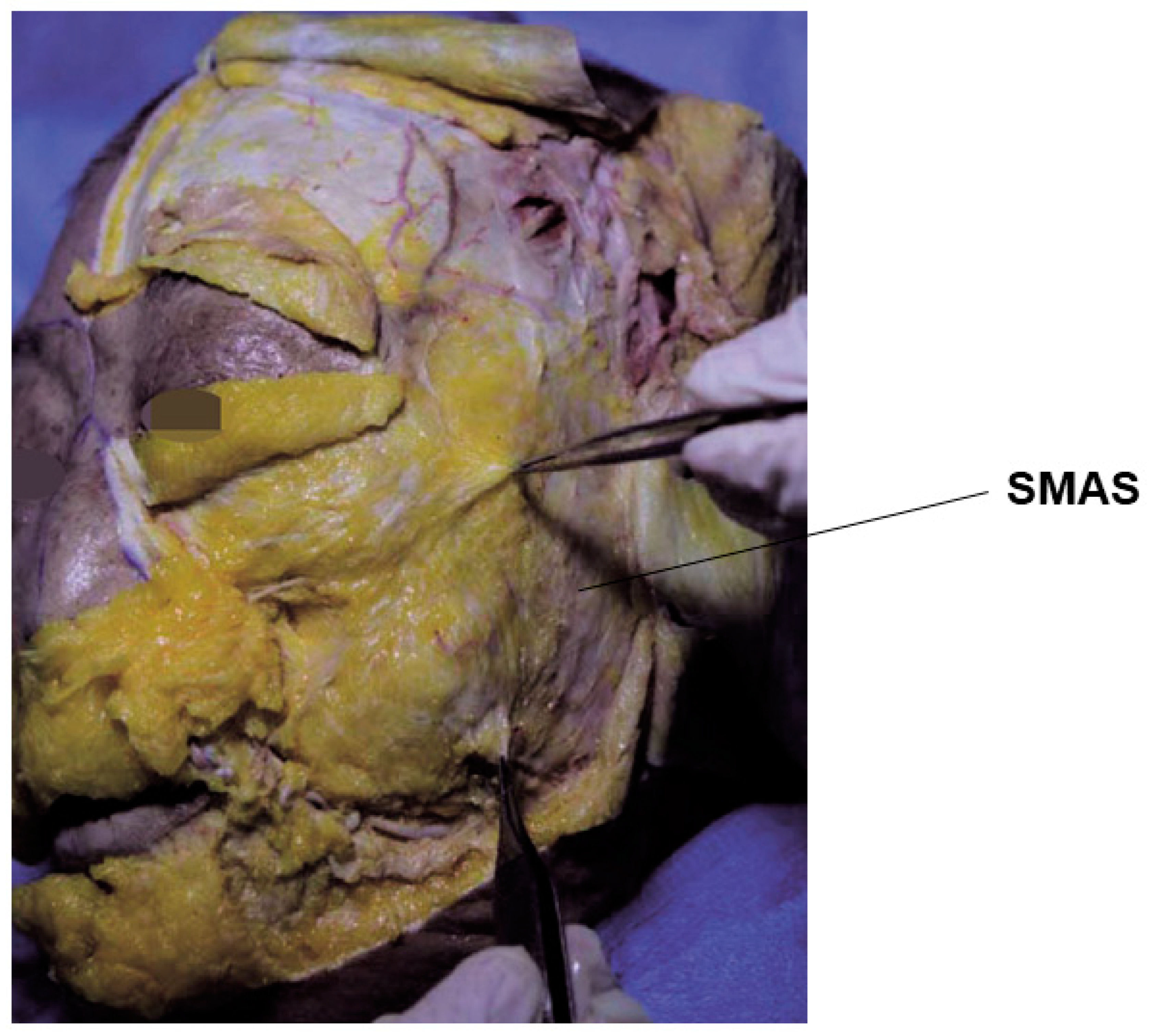Diagnostics 14 01452 g001