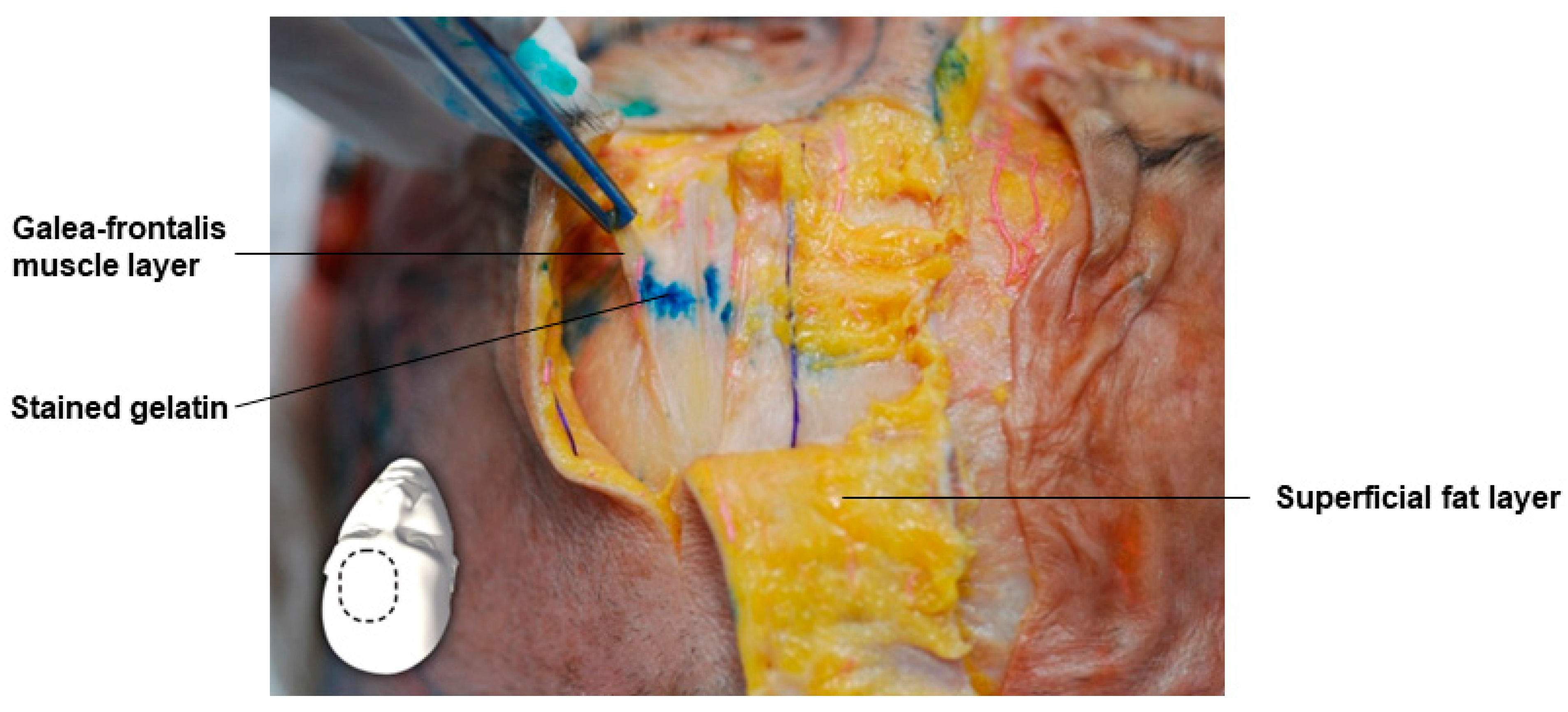 Diagnostics 14 01452 g003