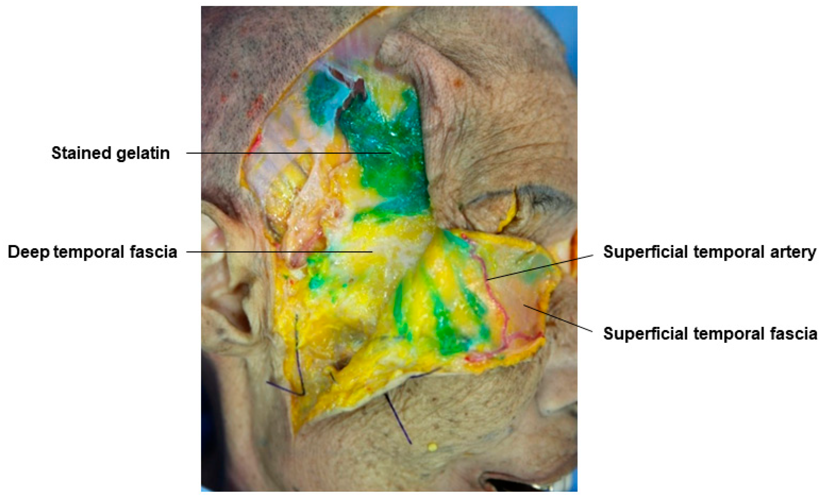 Diagnostics 14 01452 g005