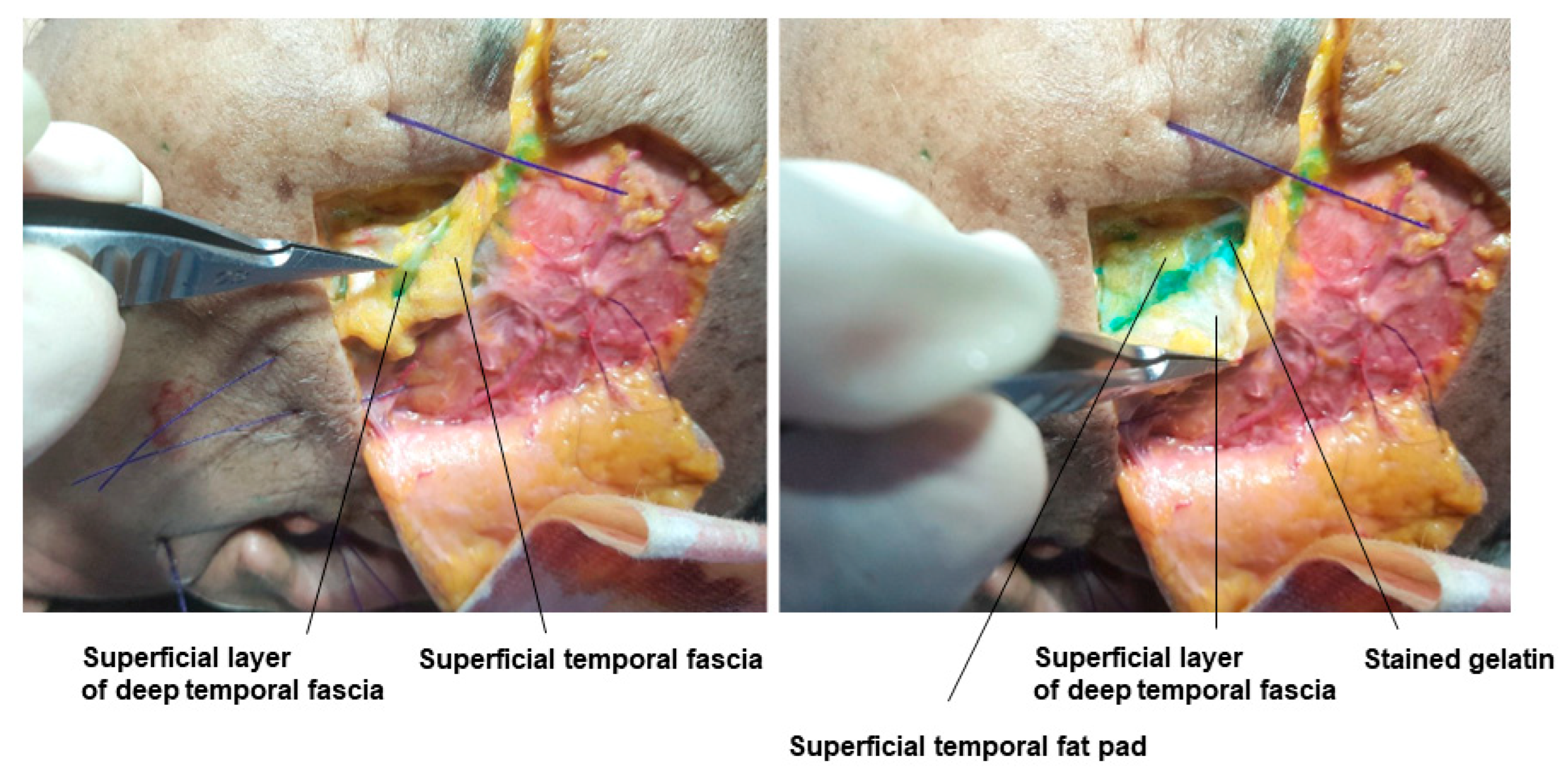 Diagnostics 14 01452 g006