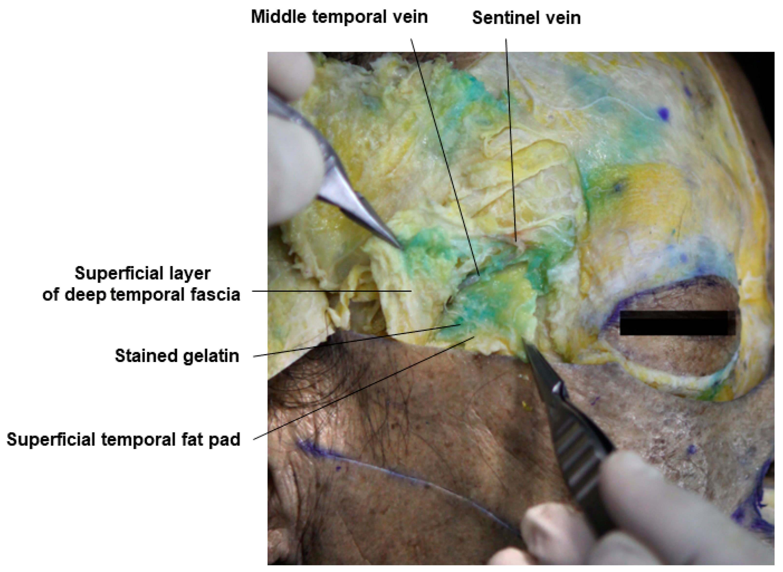 Diagnostics 14 01452 g007