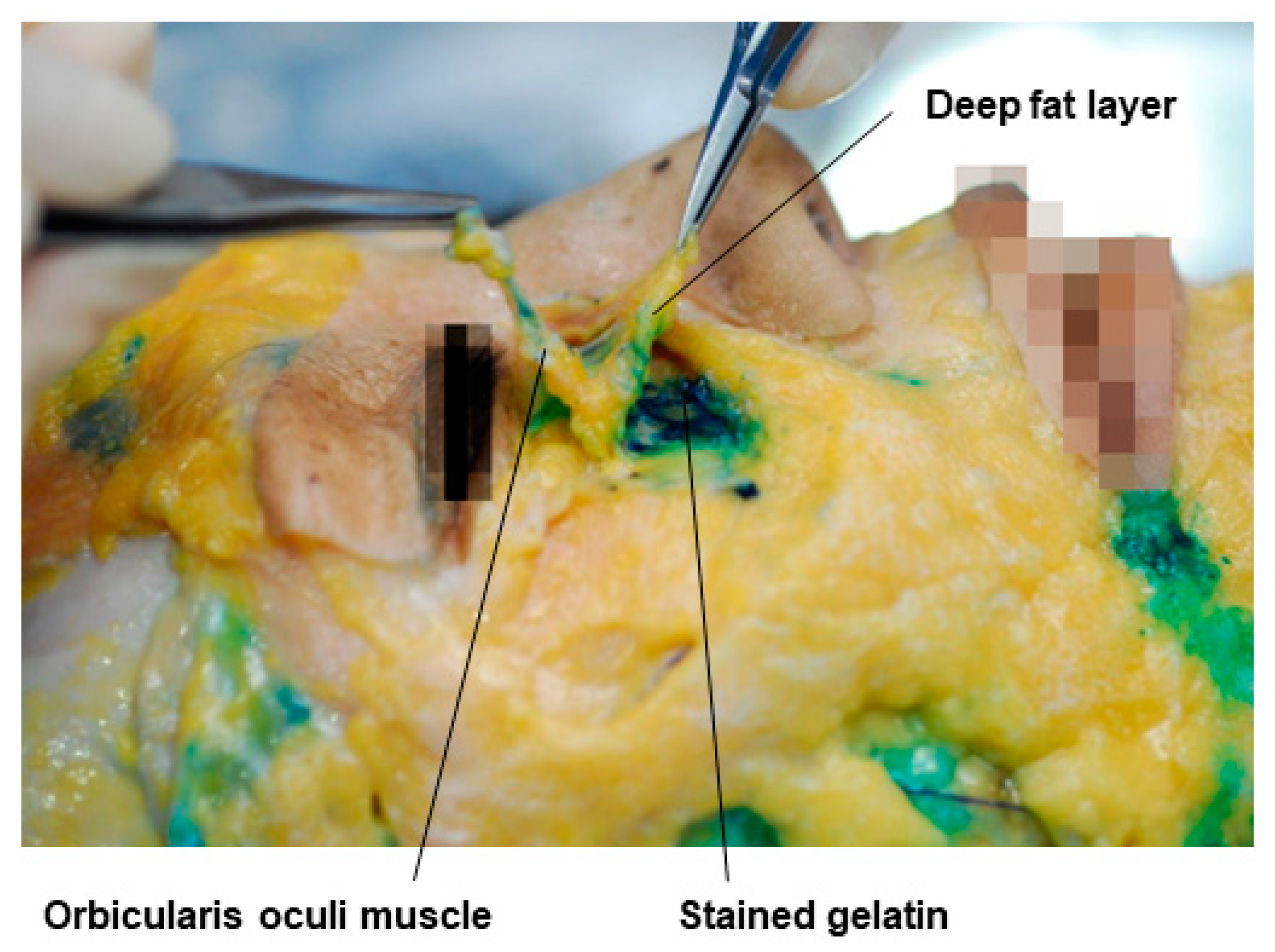 Diagnostics 14 01452 g013