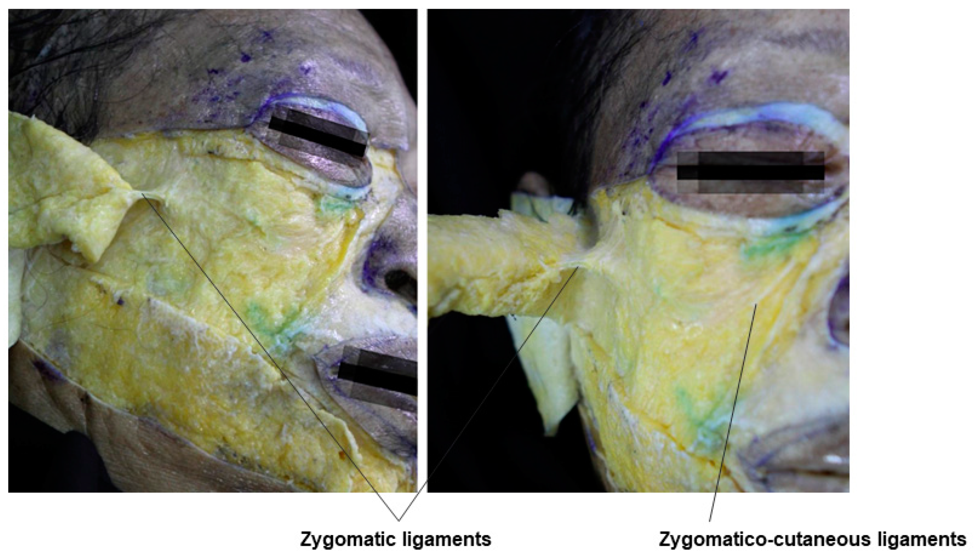 Diagnostics 14 01452 g016