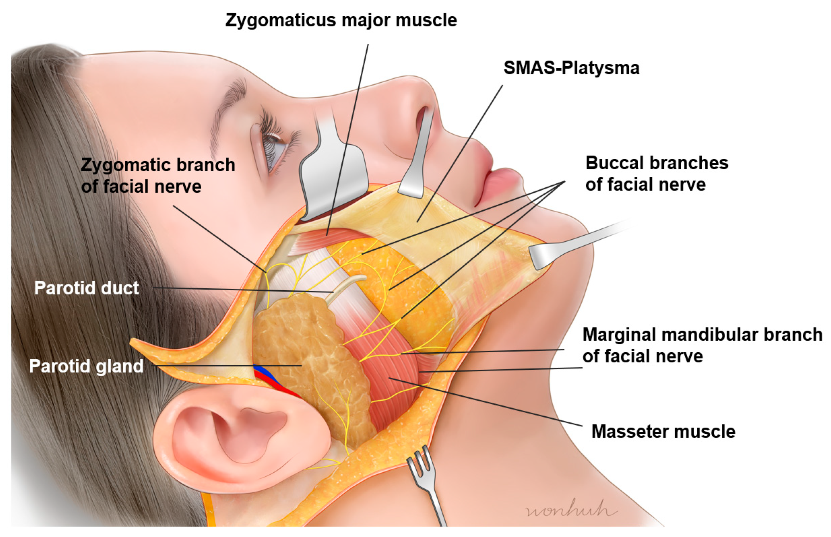 Diagnostics 14 01452 g017
