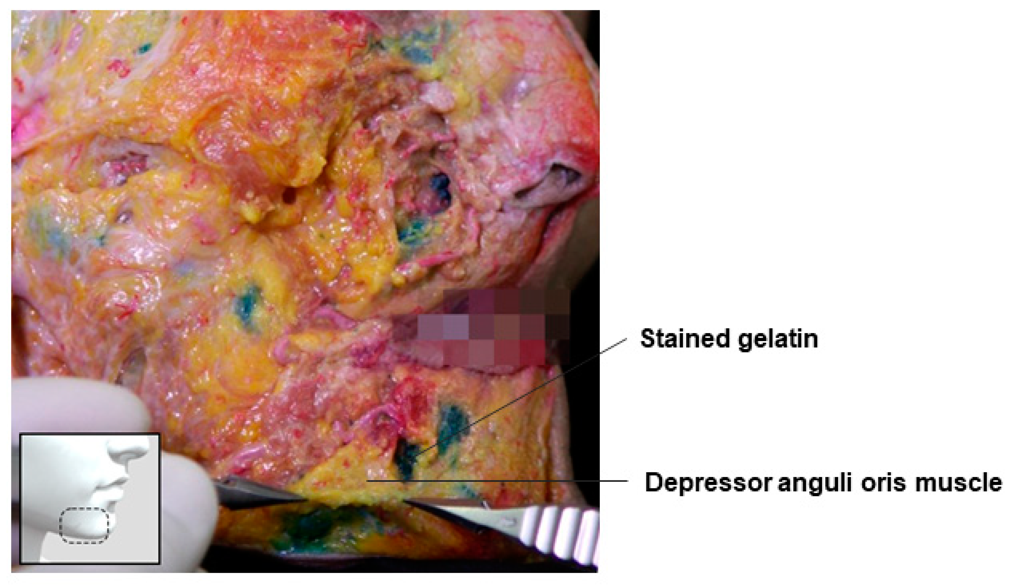 Diagnostics 14 01452 g022