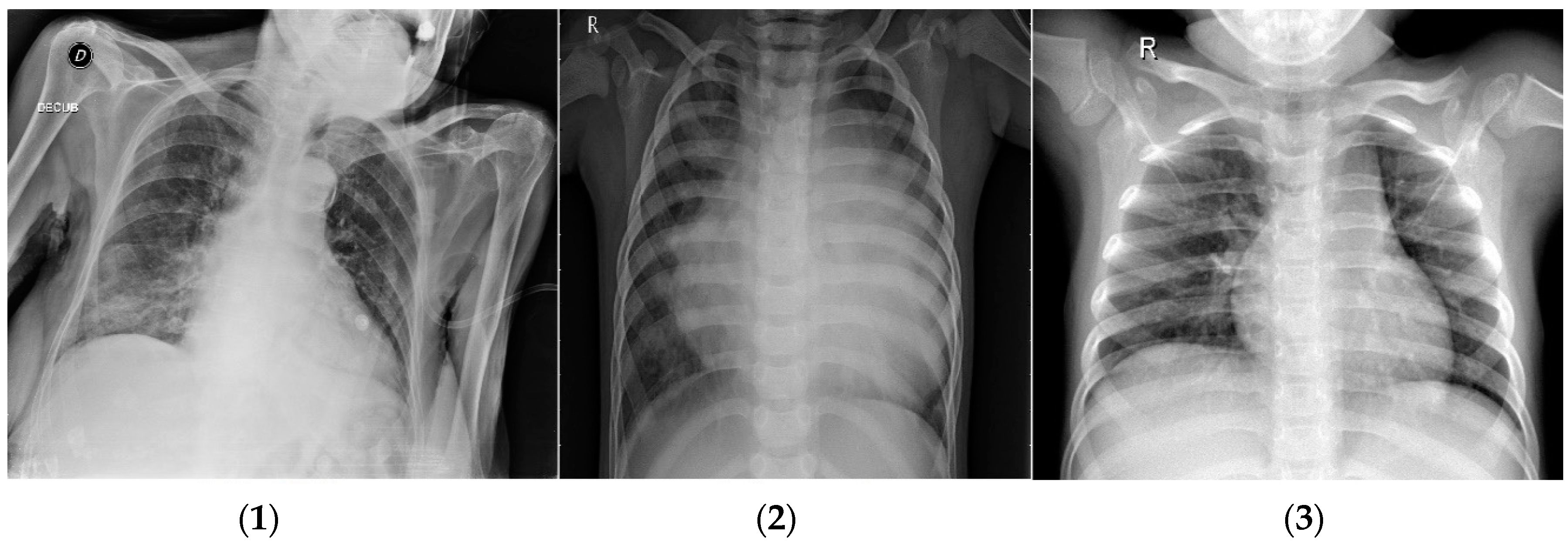 Diagnostics 14 01469 g002