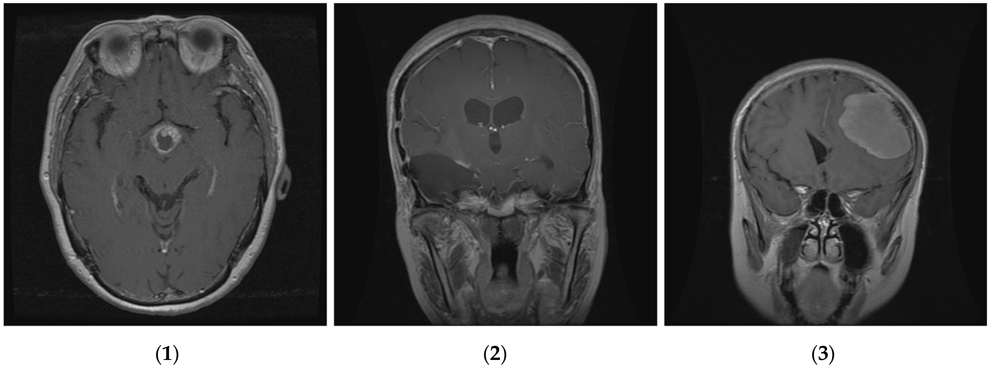 Diagnostics 14 01469 g004