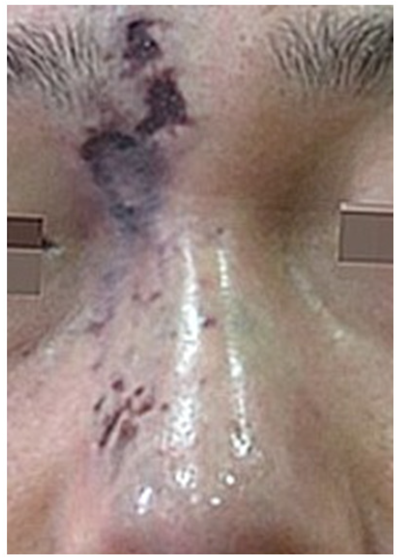 Diagnostics 14 01555 g003