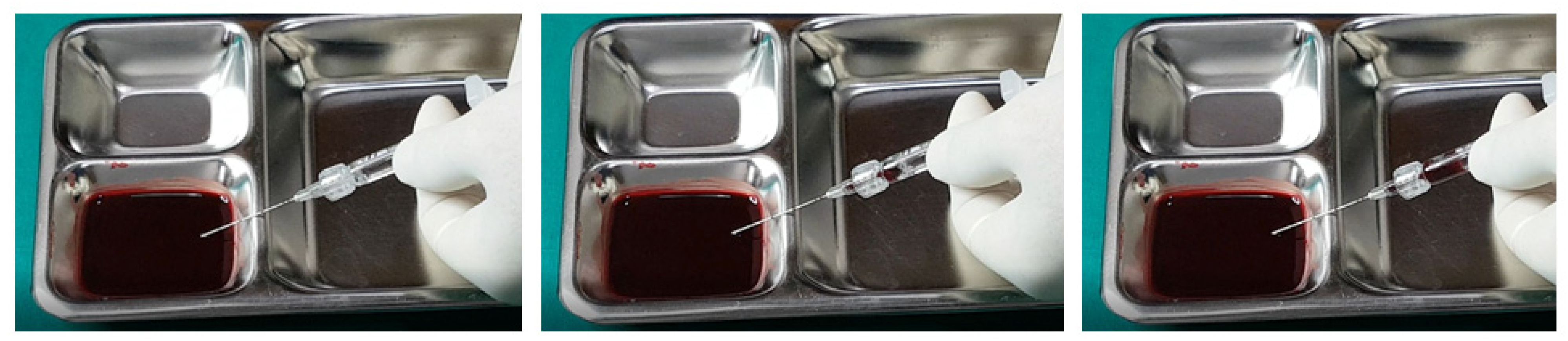 Diagnostics 14 01555 g011