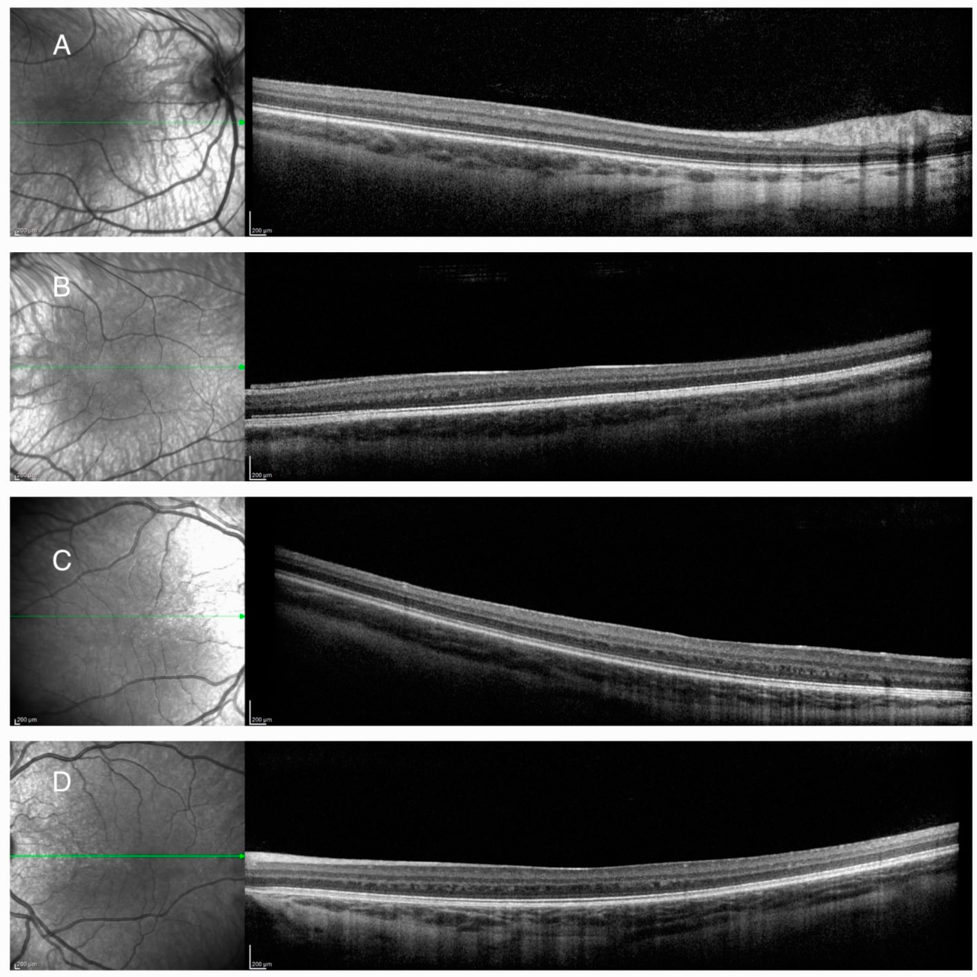 Diagnostics 14 01583 g002