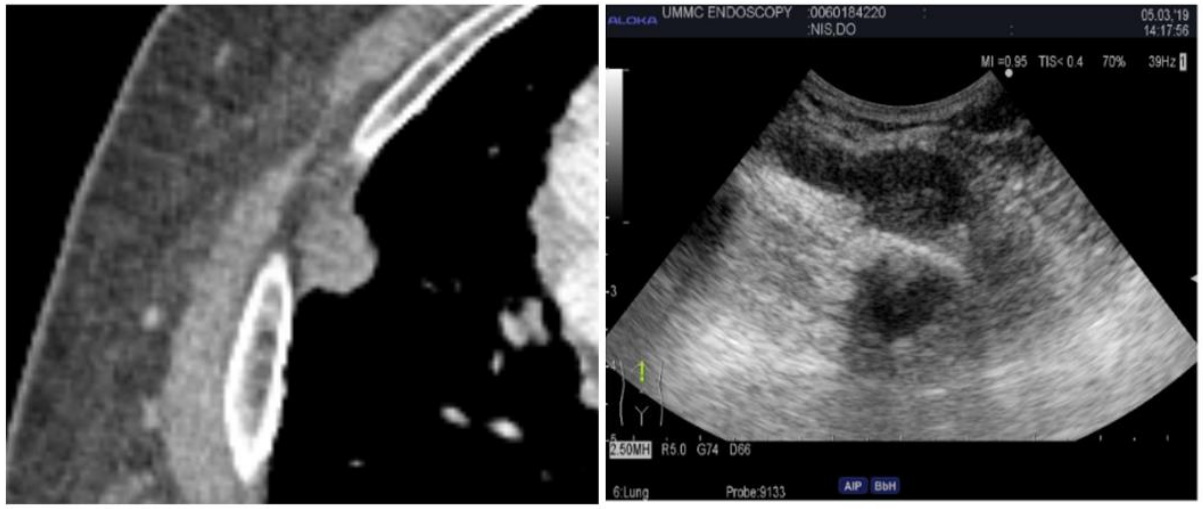 Diagnostics 14 01604 g005