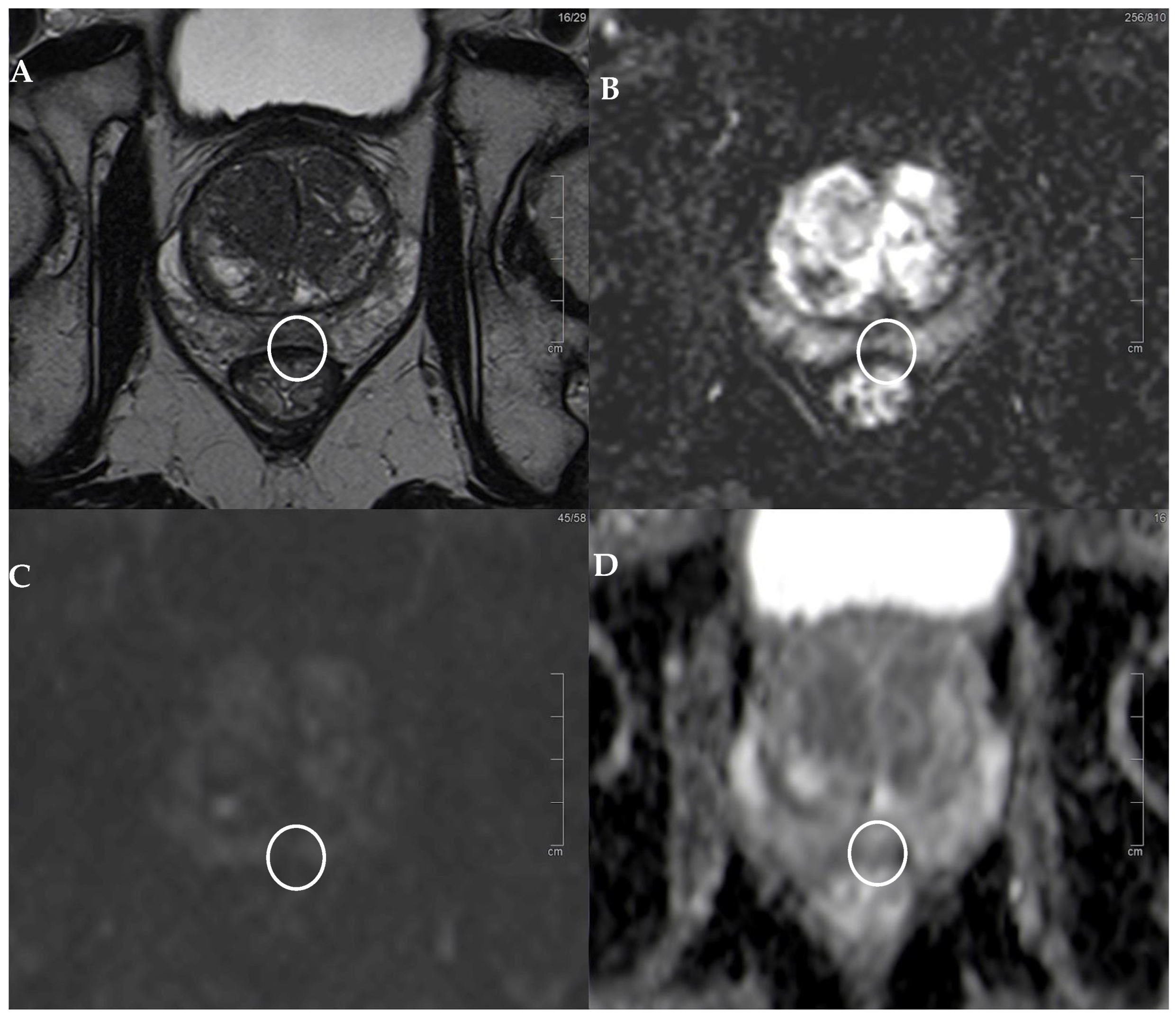 Diagnostics 14 01608 g001
