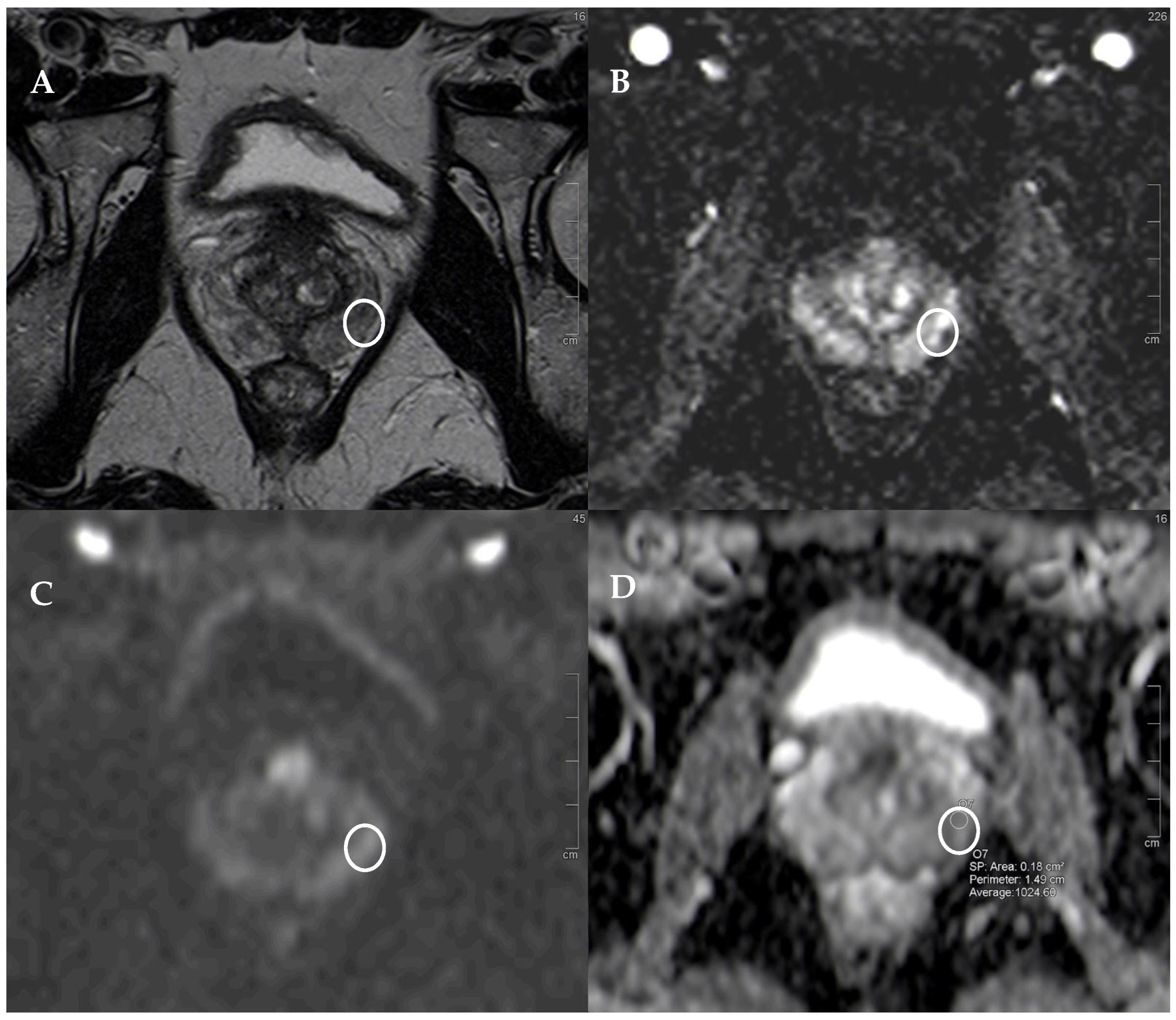 Diagnostics 14 01608 g002