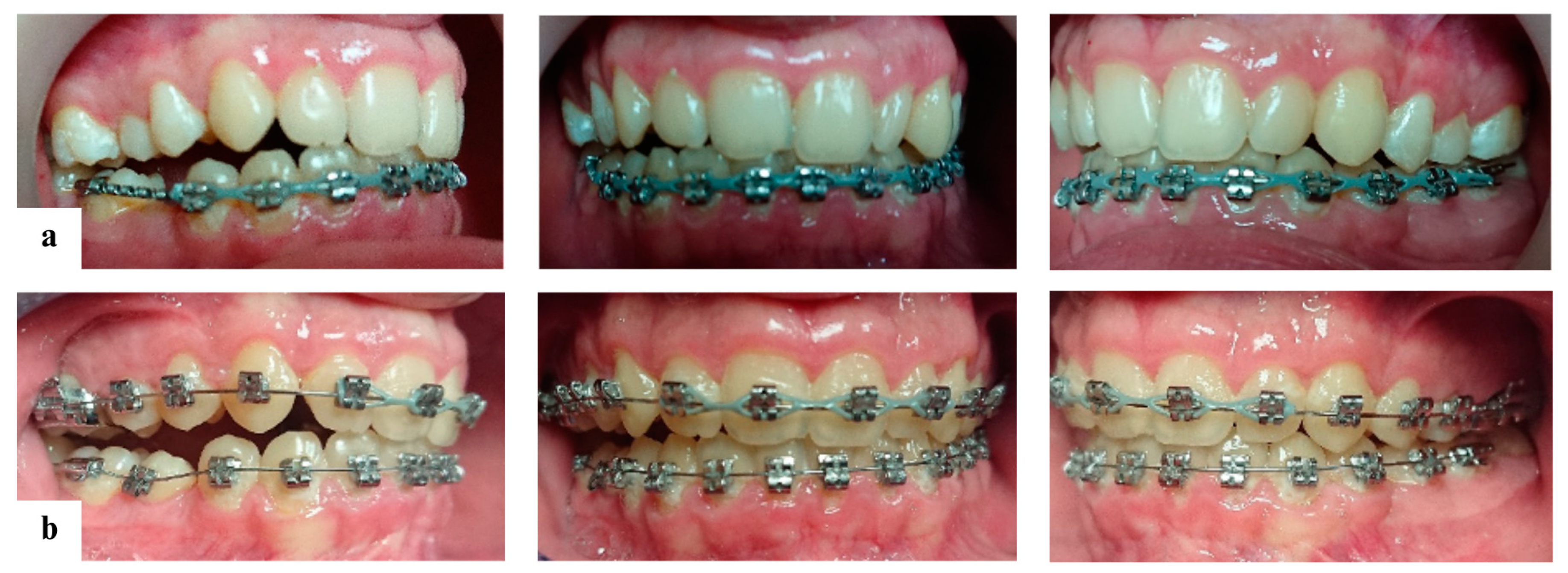 Diagnostics 14 01610 g006