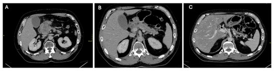 Diagnostics 14 01622 g001