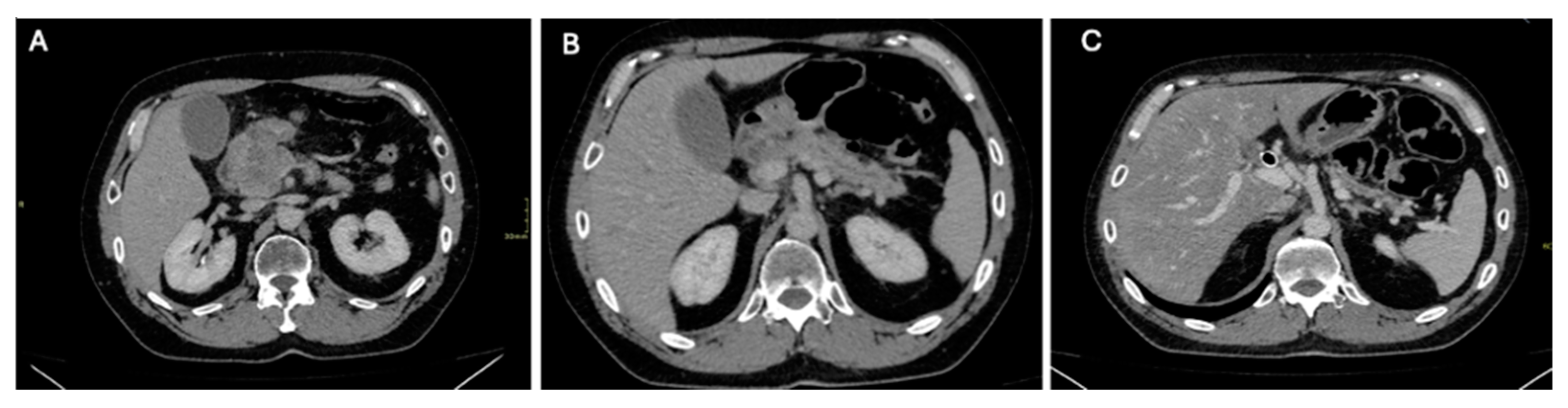 Diagnostics 14 01622 g001