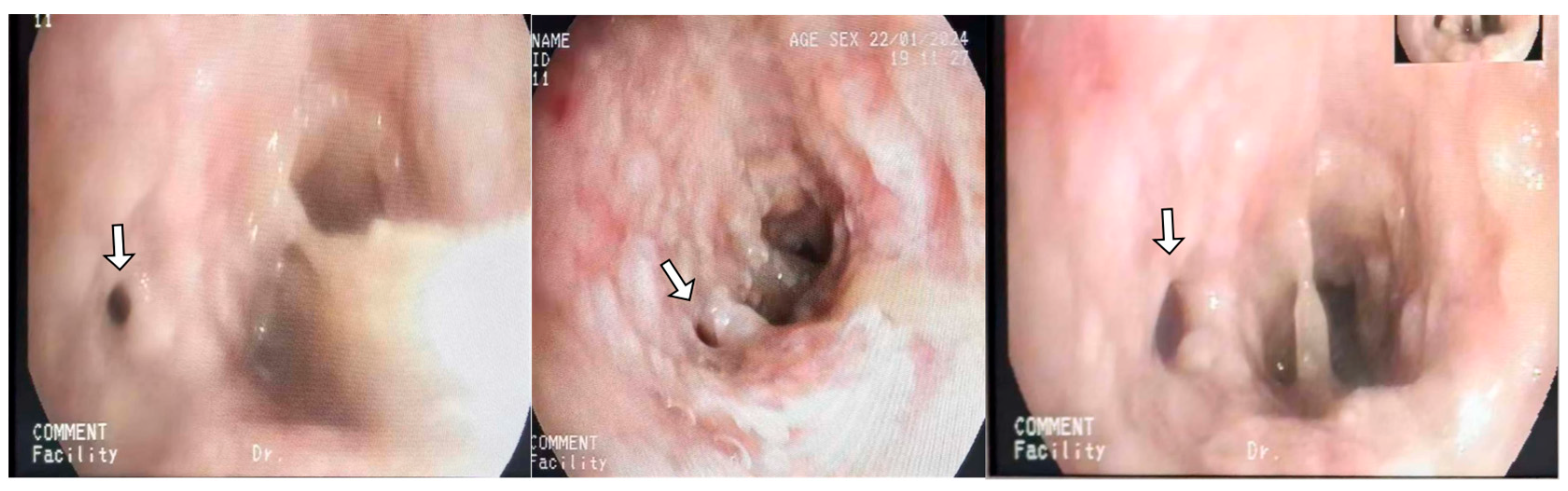 Diagnostics 14 01628 g002