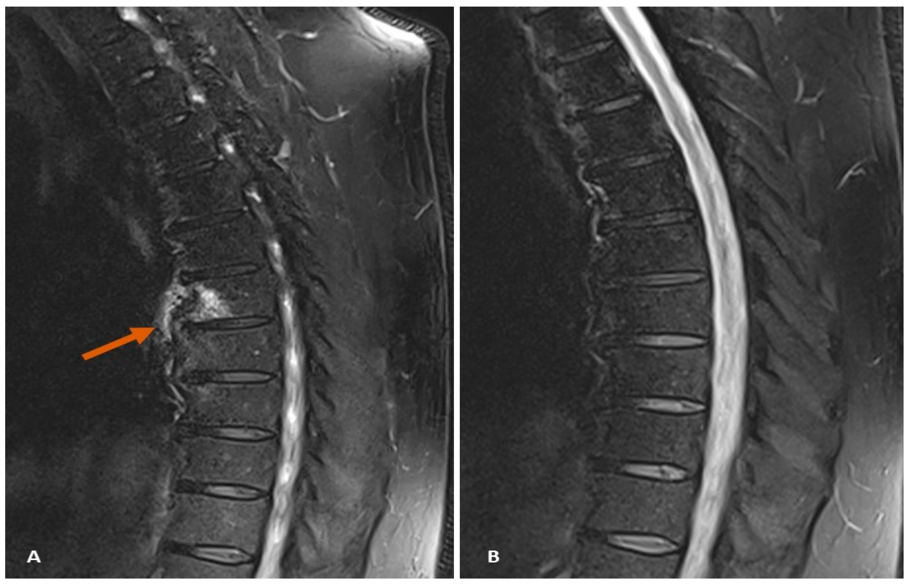 Diagnostics 14 01637 g001