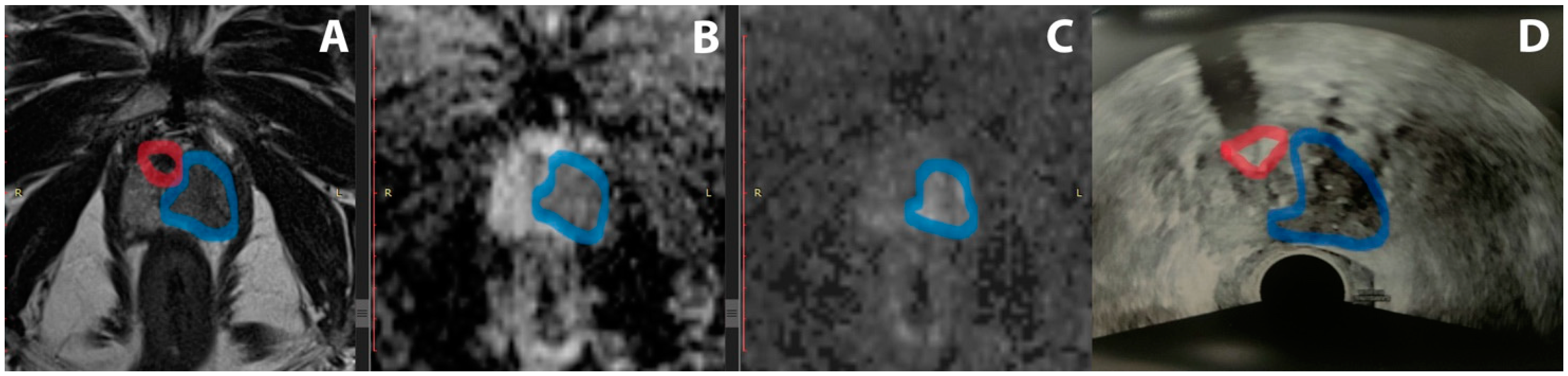Diagnostics 14 01643 g001
