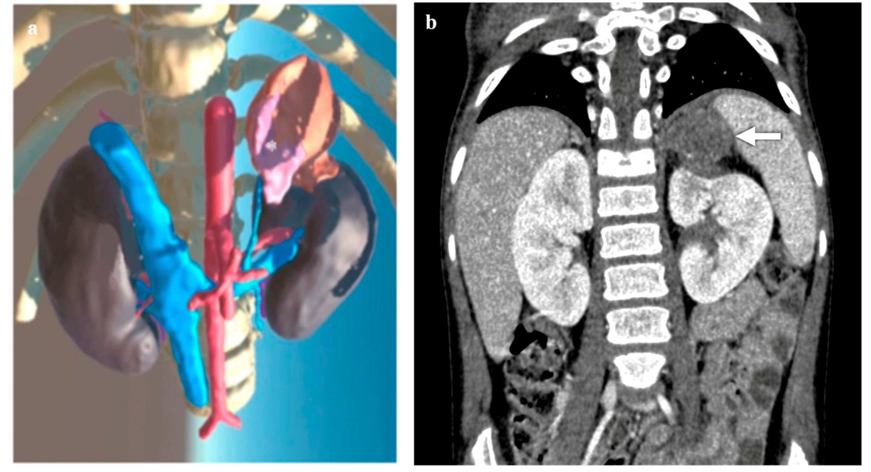 Diagnostics 14 01647 g001