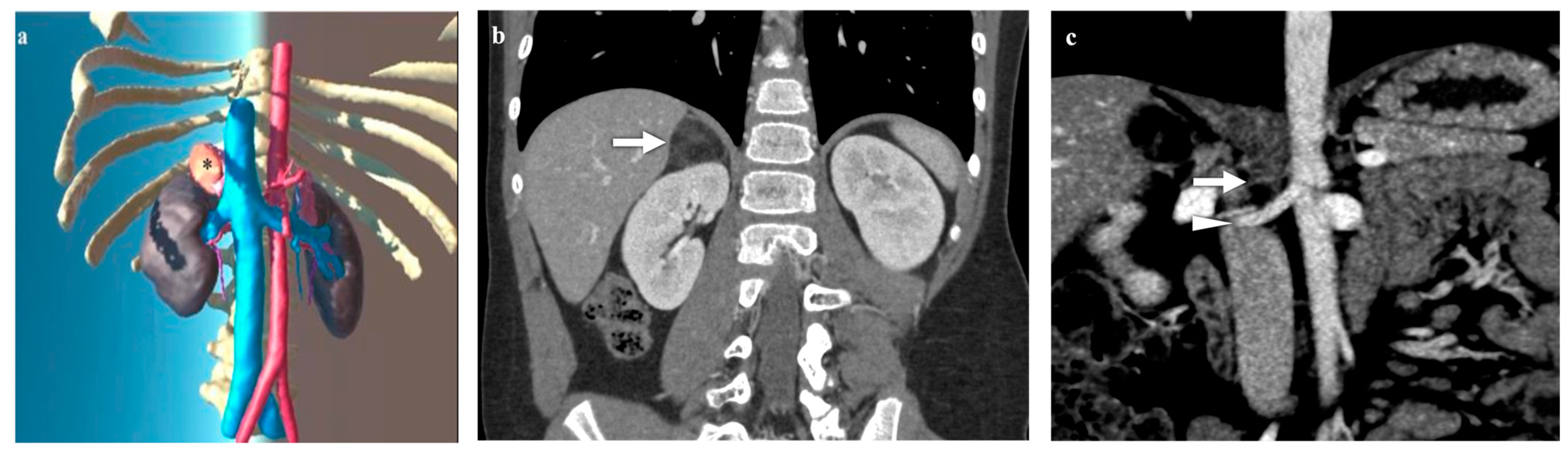 Diagnostics 14 01647 g002