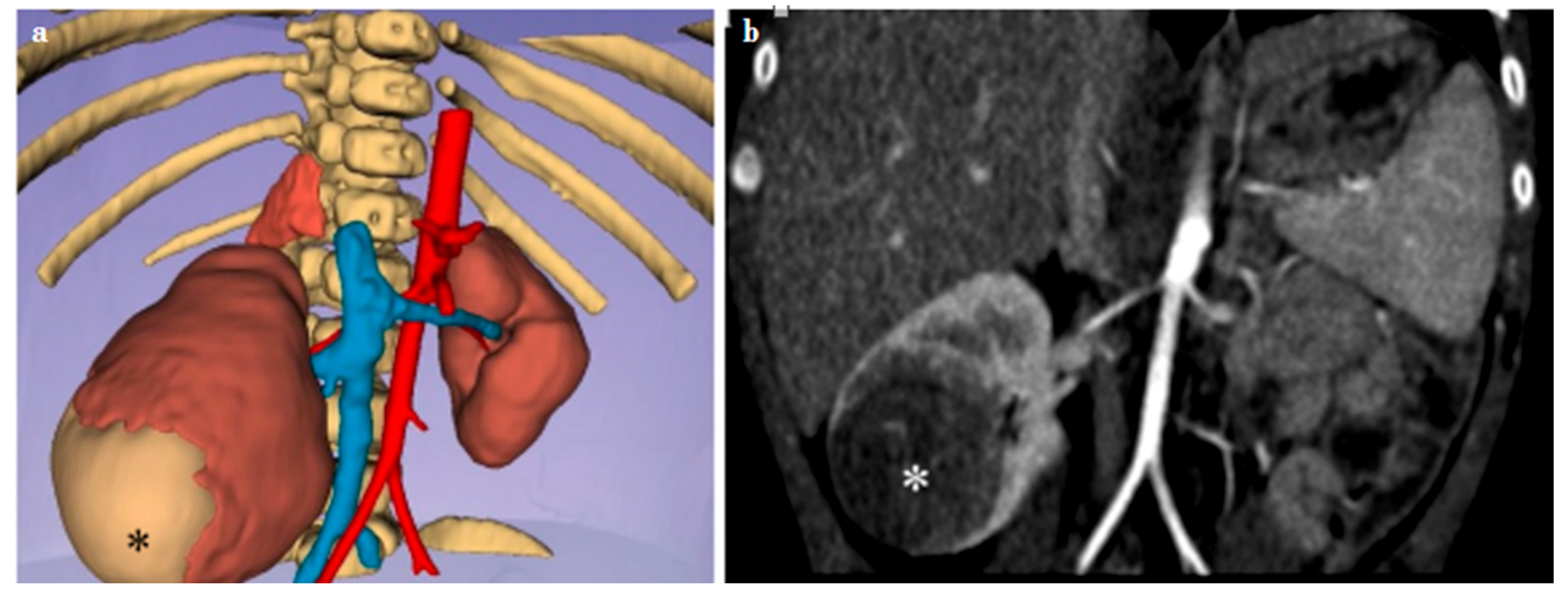 Diagnostics 14 01647 g004