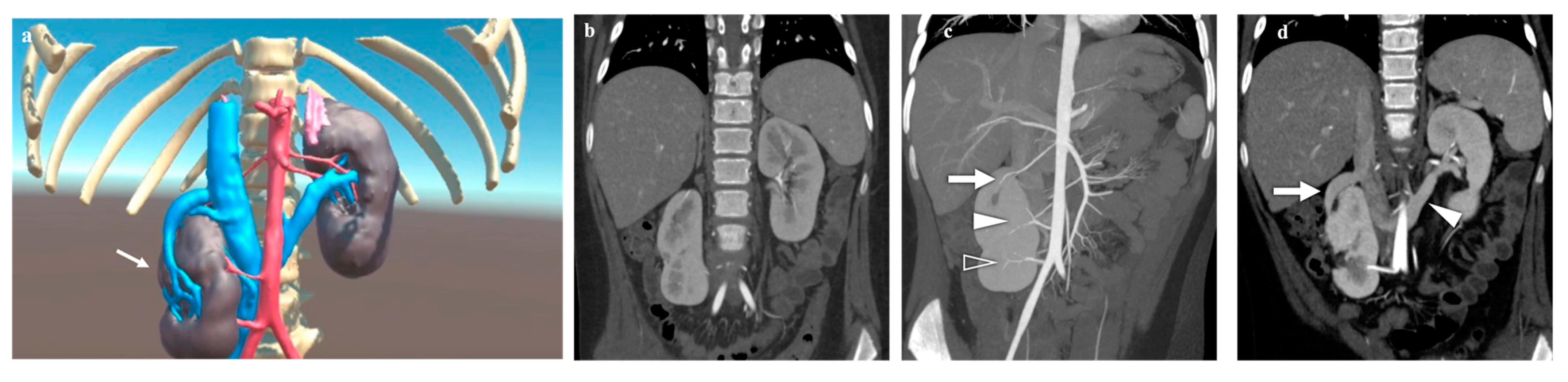 Diagnostics 14 01647 g005