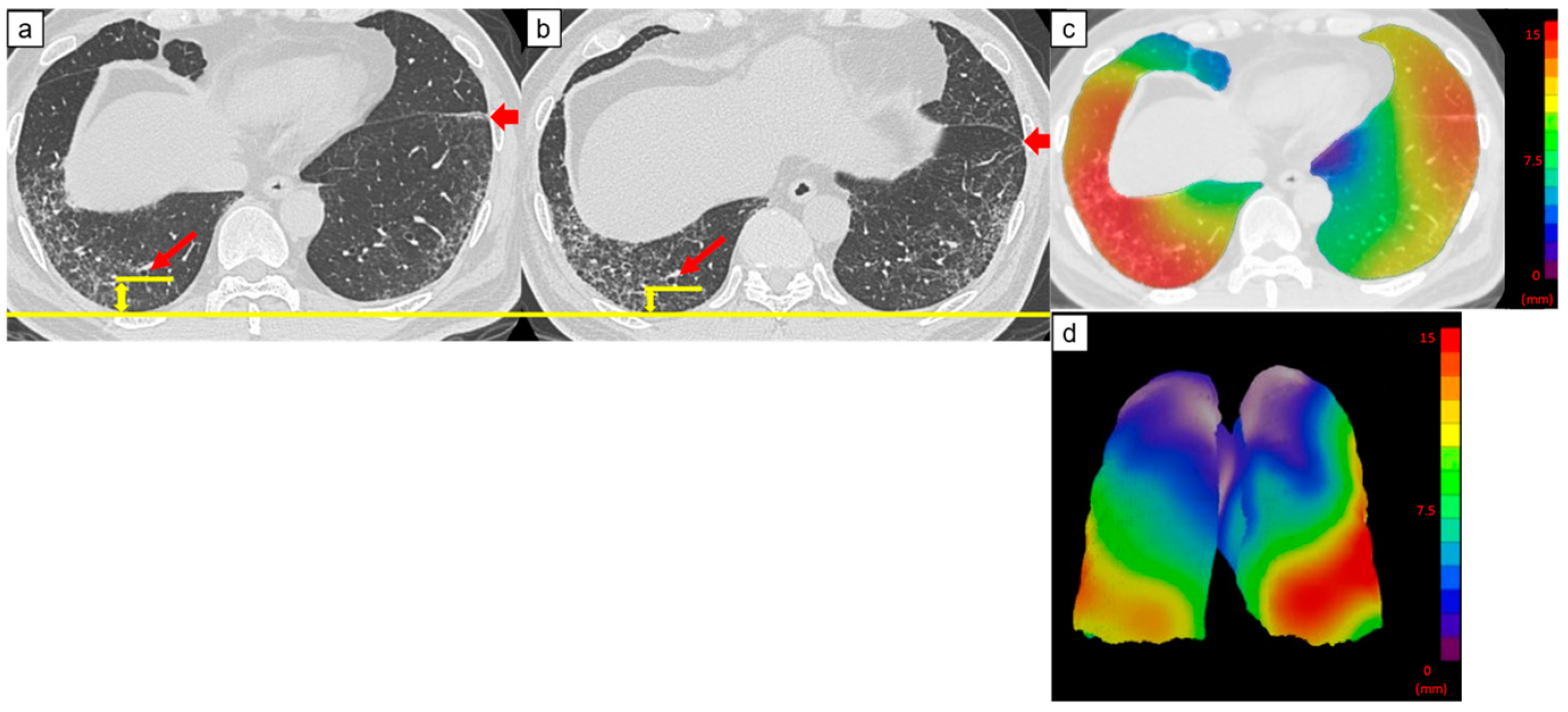 Diagnostics 14 01650 g003 Diagnostics 14 01650 g003