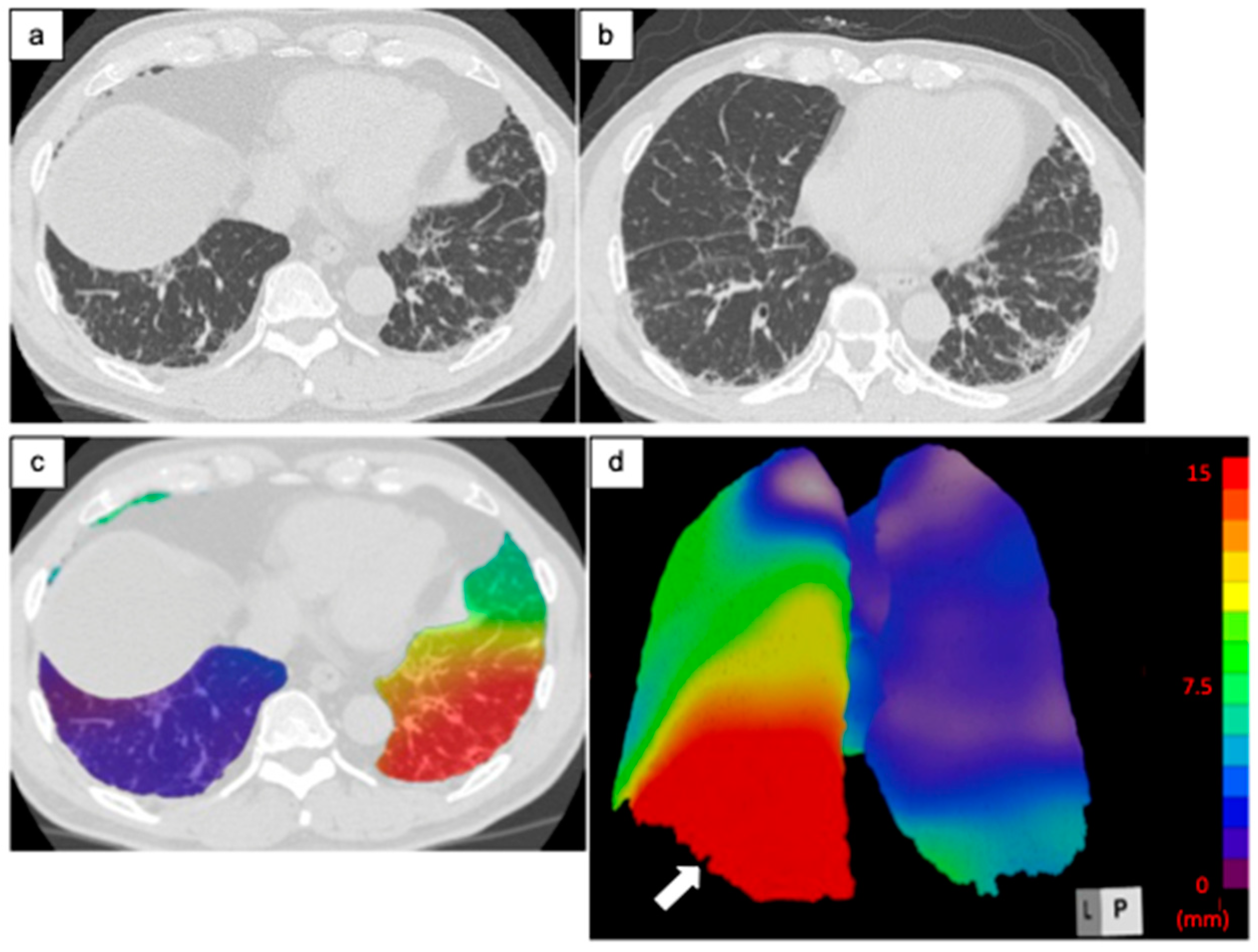 Diagnostics 14 01650 g004 Diagnostics 14 01650 g004