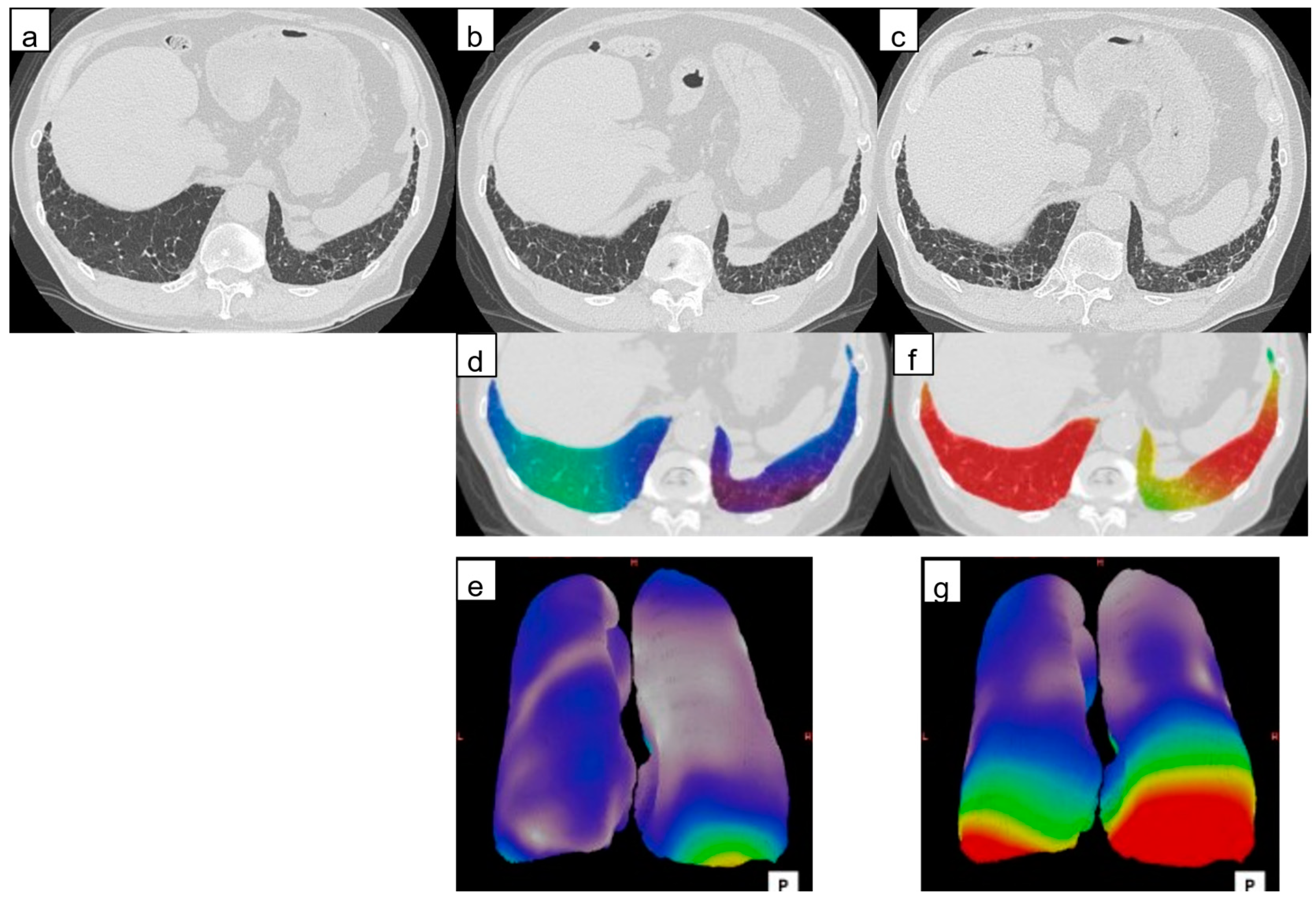 Diagnostics 14 01650 g005 Diagnostics 14 01650 g005