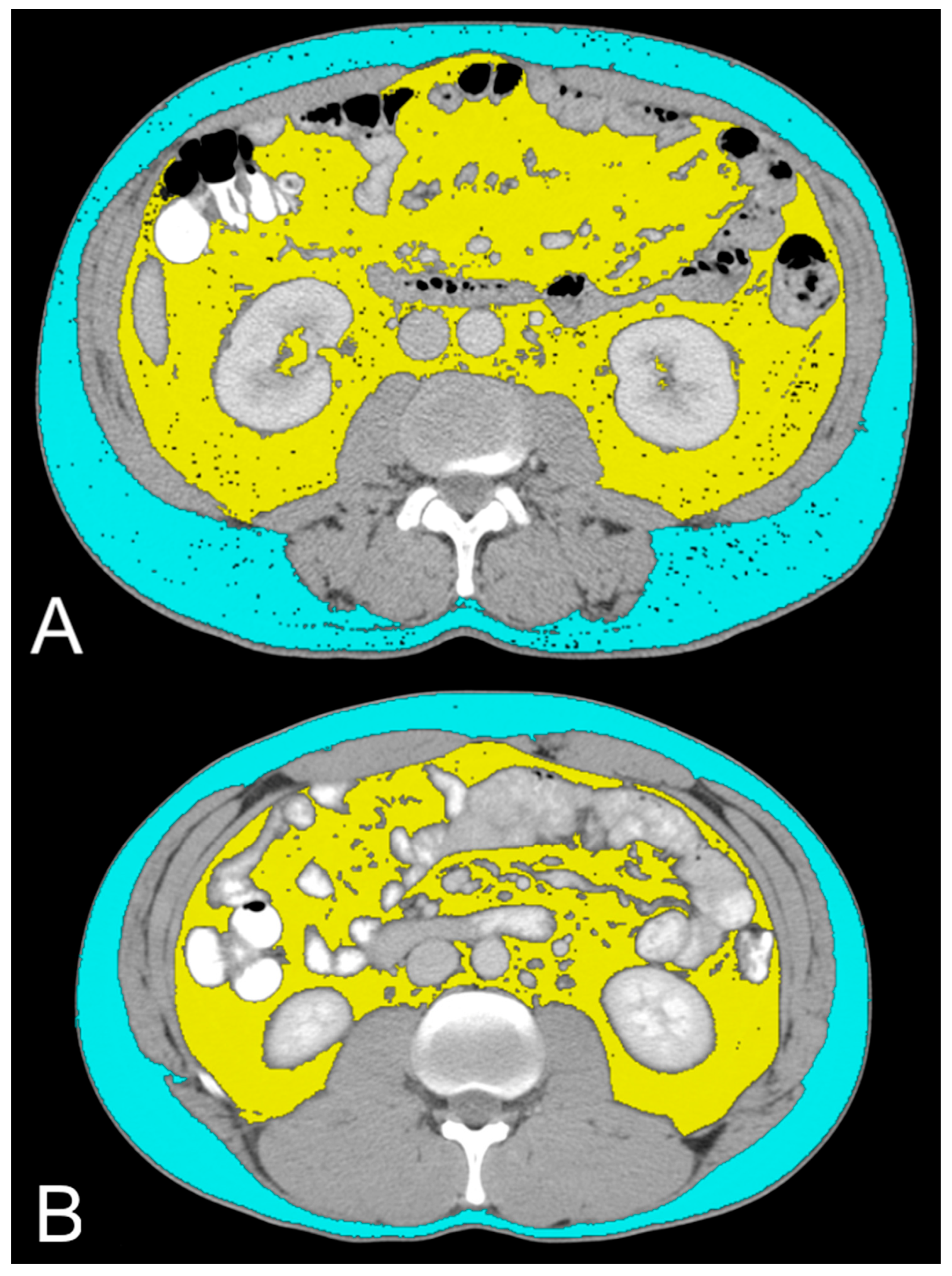 Diagnostics 14 01667 g003