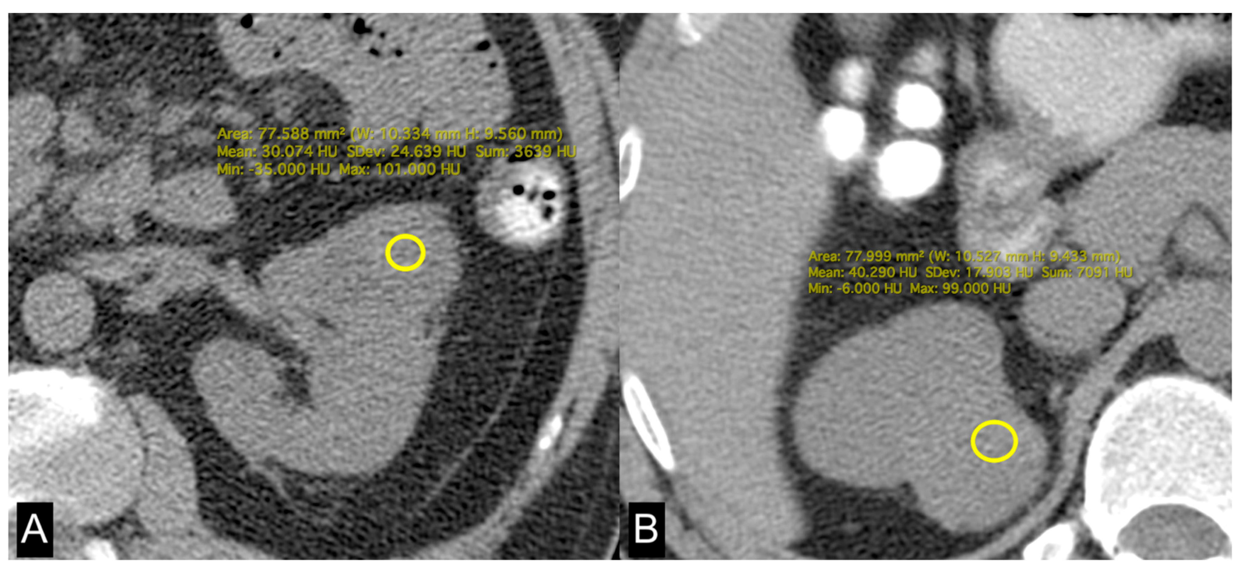 Diagnostics 14 01667 g004