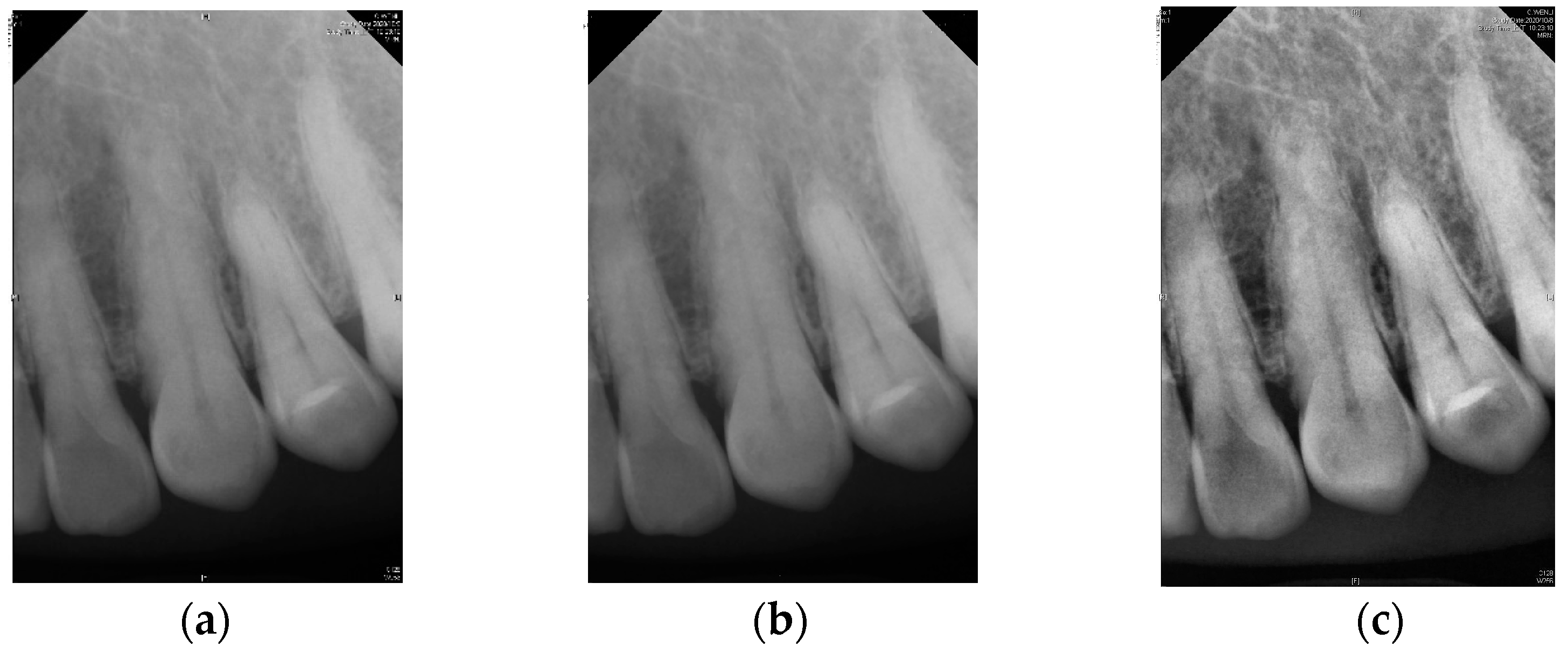 Diagnostics 14 01687 g003