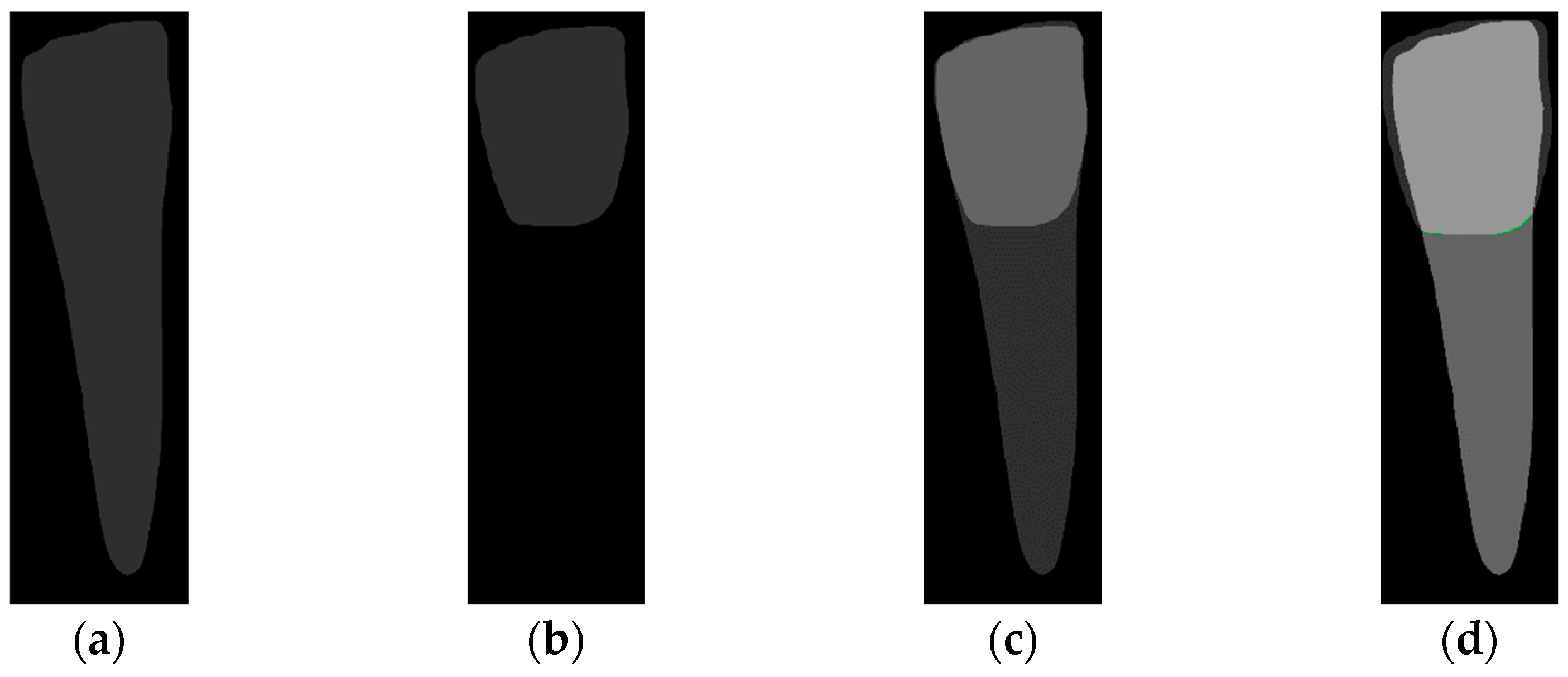 Diagnostics 14 01687 g009