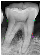Diagnostics 14 01687 i006 Diagnostics 14 01687 i006