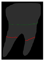 Diagnostics 14 01687 i011 Diagnostics 14 01687 i011