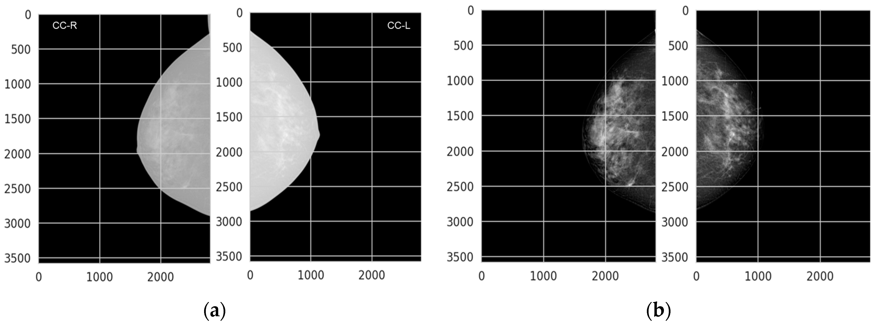 Diagnostics 14 01691 g004