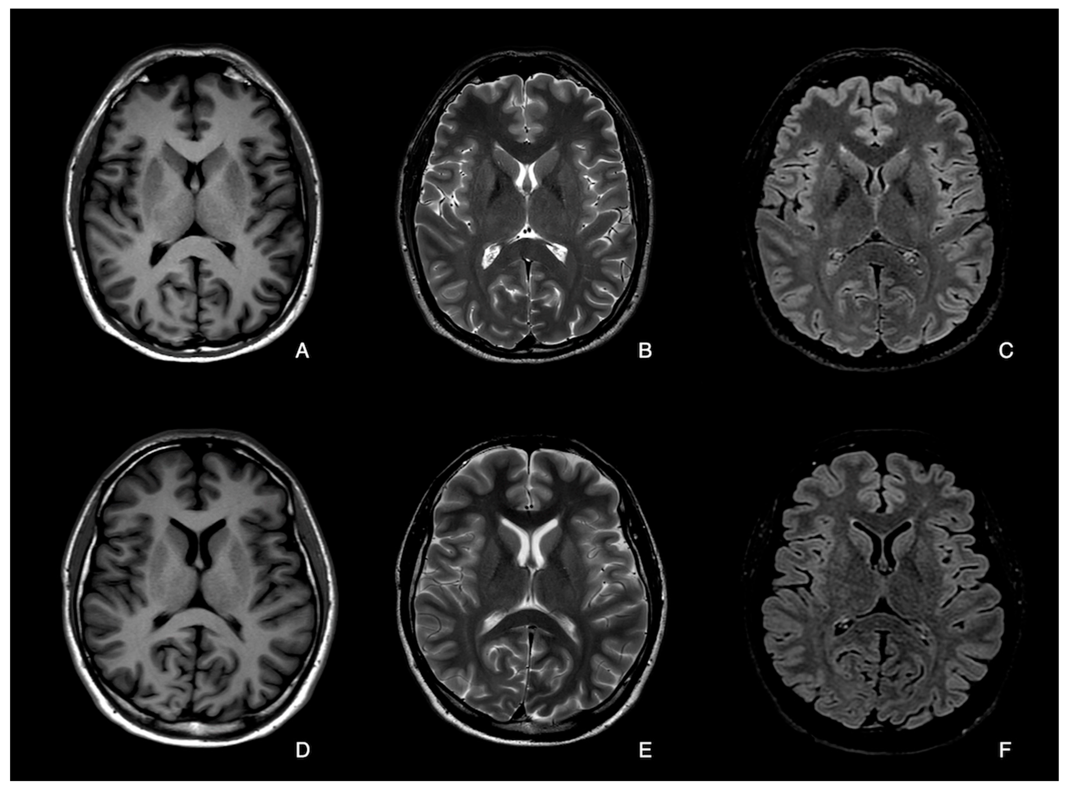 Diagnostics 14 01693 g001
