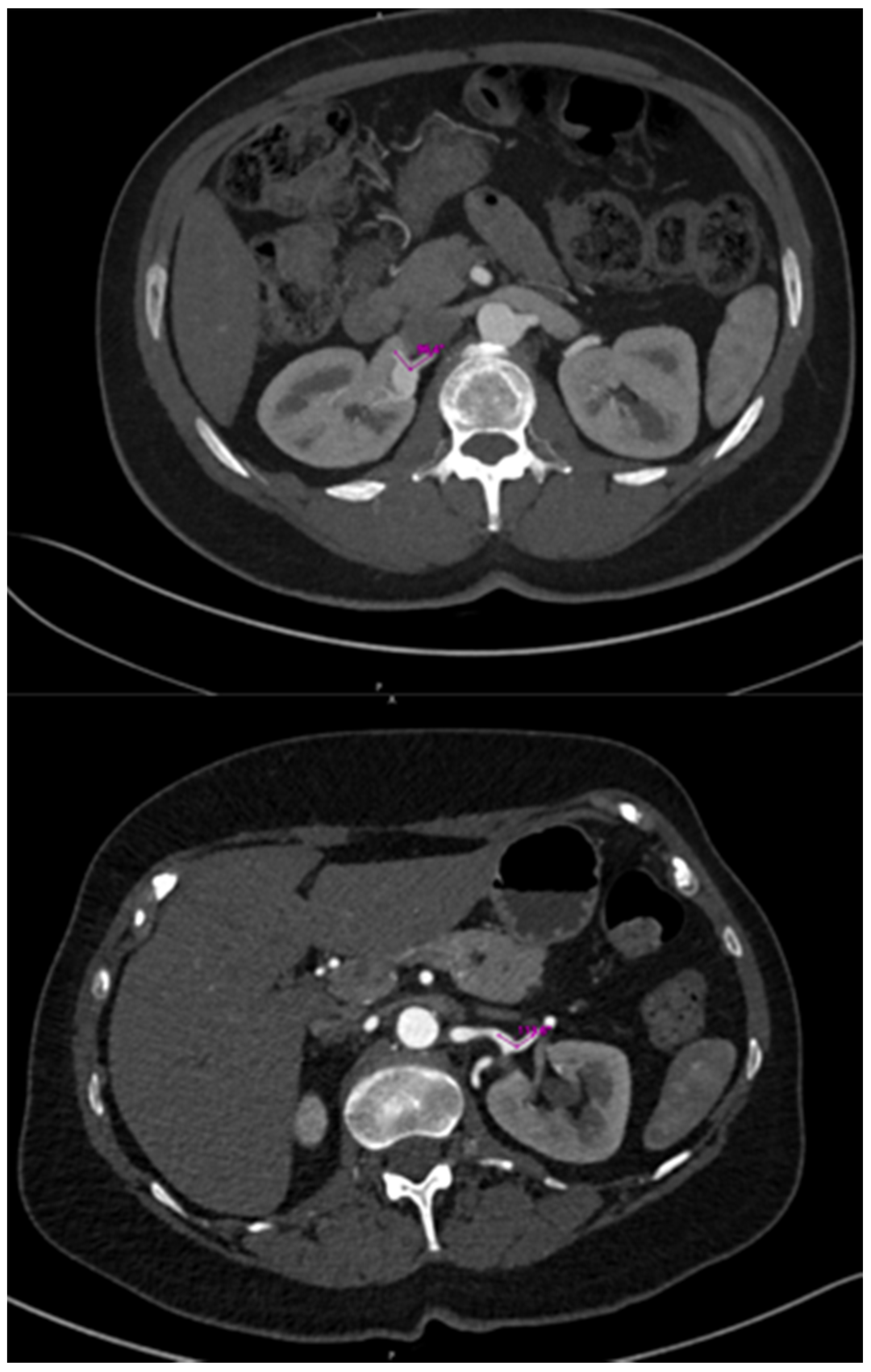 Diagnostics 14 01695 g001