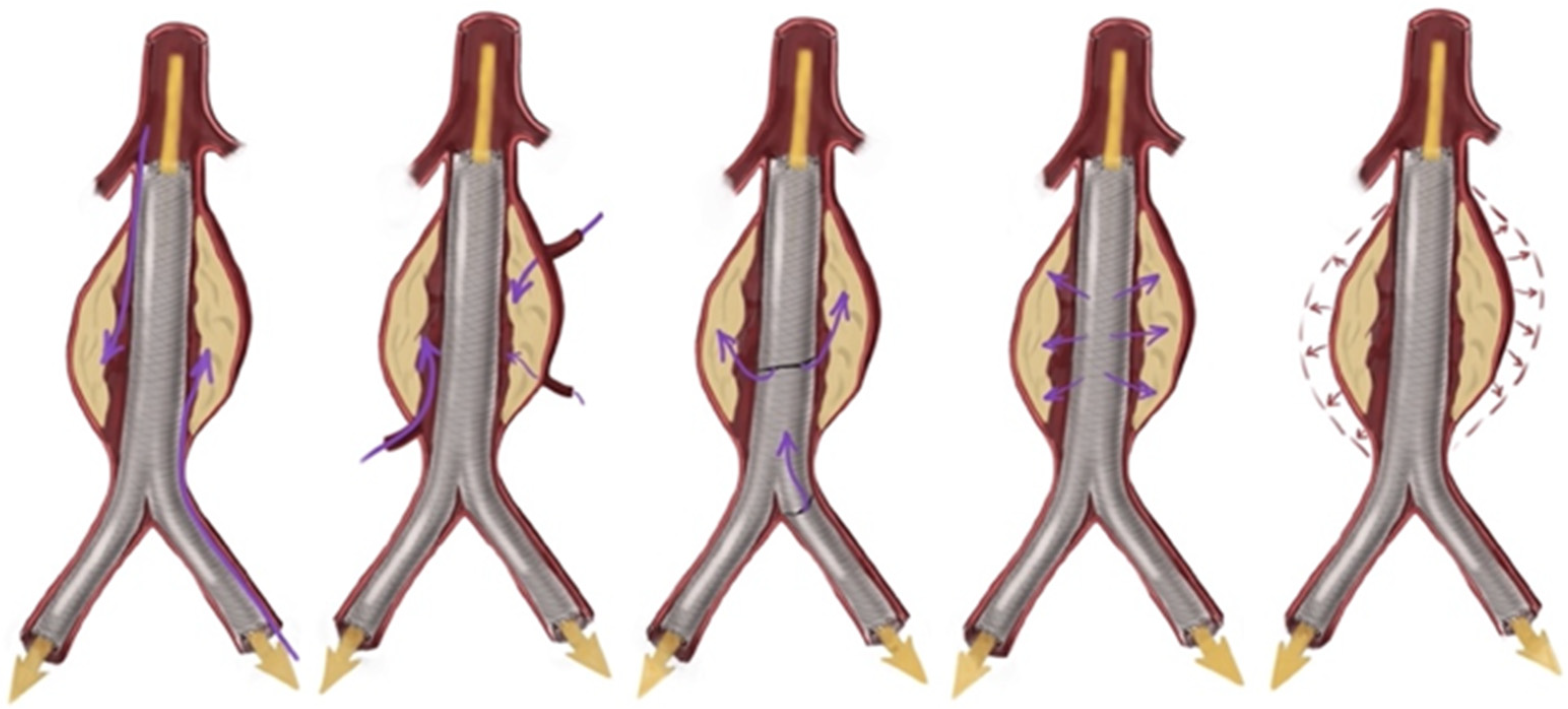 Diagnostics 14 01695 g005
